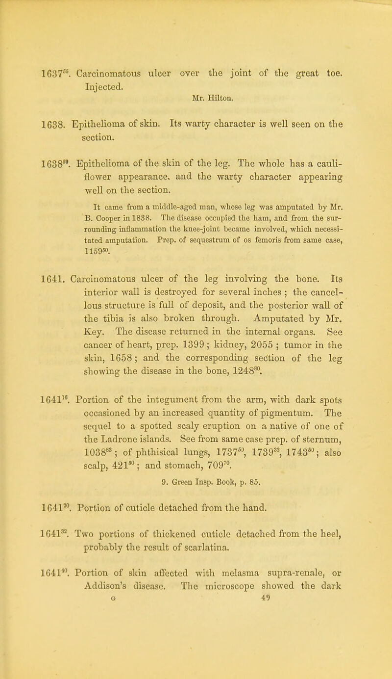 1637*. Carcinomatous ulcer over the joint of the great toe. Injected. Mr. Hilton. 1638. Epithelioma of skin. Its warty character is well seen on the section. 1638'°. Epithelioma of the skin of the leg. The whole has a cauli- flower appearance, and the warty character appearing well on the section. It came from a middle-aged man, whose leg was amputated by Mr. B. Cooper in 1838. The disease occupied the ham, and from the sur- rounding inflammation the knee-joint became involved, -which necessi- tated amputation. Prep, of sequestrum of OS femoris from same case, 115950. 1641. Carcinomatous ulcer of the leg involving the bone. Its interior wall is destroyed for several inches ; the cancel- lous structure is full of deposit, and the posterior wall of the tibia is also broken through. Amputated by Mr. Key. The disease returned in the internal organs. See cancer of heart, prep. 1399 ; kidney, 2055 ; tumor in the skin, 1658; and the corresponding section of the leg showing the disease in the bone, 1248^. 1641. Portion of the integument from the arm, with dark spots occasioned by an increased quantity of pigmentum. The seqiiel to a spotted scaly eruption on a native of one of the Ladrone islands. See from same case prep, of sternum, 1038^; of phthisical lungs, 1737% 1739=^ 1743*°; also scalp, 421*°; and stomach, 709™. 9. Green Insp. Book, p. 85. 1641^. Portion of cuticle detached from the hand. 1641. Two portions of thickened cuticle detached from the heel, probably the result of scarlatina. 1041*. Portion of skin affected with melasma supra-renale, or Addison's disease. The microscope showed the dark