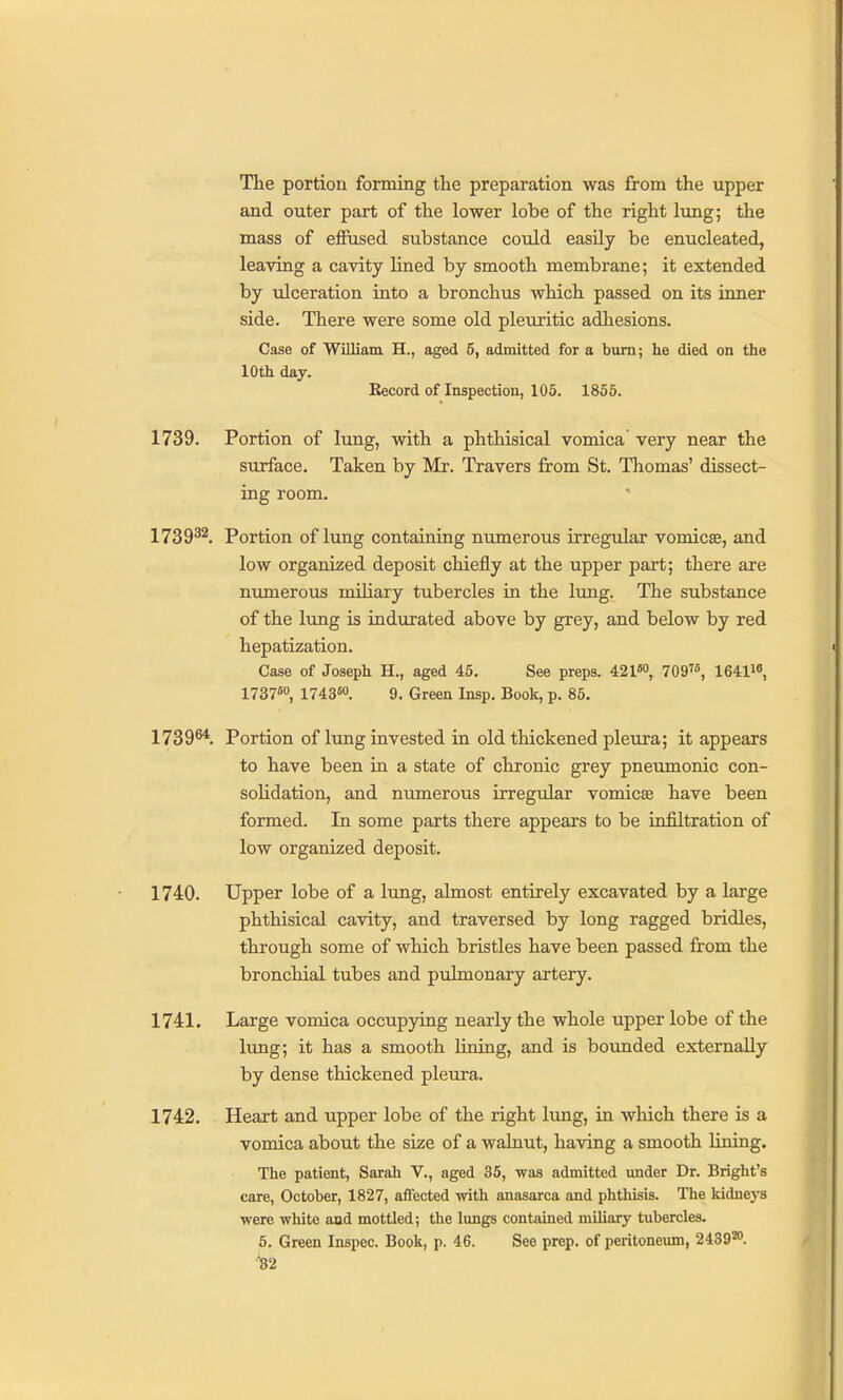 The portion forming the preparation was from the upper and outer part of the lower lobe of the right lung; the mass of effused substance could easUy be enucleated, leaving a cavity lined by smooth membrane; it extended by ulceration into a bronchus which passed on its inner side. There were some old pleuritic adhesions. Case of William H., aged 5, admitted for a bum; he died on the 10th day. Record of Inspection, 105. 1855. 1739. Portion of lung, with a phthisical vomica very near the surface. Taken by Mr. Travers from St. Thomas' dissect- ing room. 1739^^. Portion of lung containing numerous irregular vomicae, and low organized deposit chiefly at the upper part; there are numerous mihary tubercles in the lung. The substance of the lung is indurated above by grey, and below by red hepatization. Case of Joseph H., aged 45. See preps. 421*'', 709'«, 1641i« 1737«o, 1743«o. 9. Green Insp. Book, p. 85. 1739^. Portion of lung invested in old tliickened pleura; it appears to have been in a state of chronic grey pneumonic con- solidation, and numerous irregular vomicae have been formed. In some parts there appears to be infiltration of low organized deposit. 1740. Upper lobe of a lung, almost entirely excavated by a large phthisical cavity, and traversed by long ragged bridles, through some of which bristles have been passed fi'om the bronchial tubes and pulmonary artery. 1741. Large vomica occupying nearly the whole upper lobe of the lung; it has a smooth lining, and is bounded externally by dense thickened pleura. 1742. Heart and upper lobe of the right limg, in which there is a vomica about the size of a walnut, having a smooth lining. The patient, Sarah V., aged 36, was admitted under Dr. Bright's care, October, 1827, affected with anasarca and phthisis. The kidneys were wliite aad mottled; the lungs contained miliary tubercles. 5. Green Inspec. Book, p. 46. See prep, of peritoneimi, 243920. ■^2
