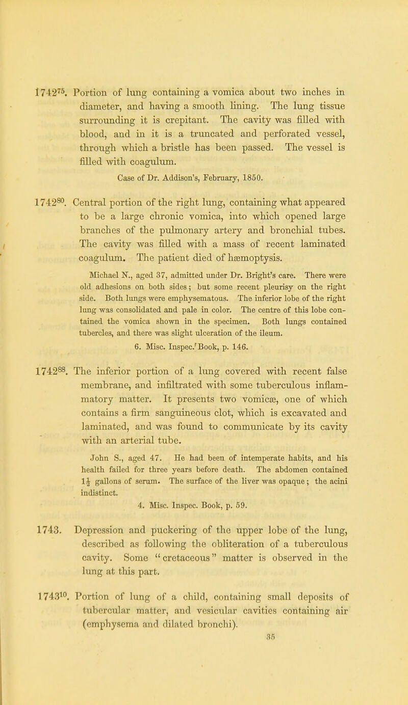 1742^5. Portion of lung containing a vomica about two inches in diameter, and having a smooth lining. The lung tissue surrounding it is crepitant. The cavity was filled with blood, and in it is a truncated and perforated vessel, through which a bristle has been passed. The vessel is filled with coagulum. Case of Dr. Addison's, February, 1850. 174280, Central portion of the right liang, containing what appeared to be a large chronic vomica, into which opened large branches of the pulmonary artery and bronchial tubes. The cavity was filled with a mass of recent laminated coagulum. The patient died of hsemoptysis. INIichael N., aged 37, admitted under Dr. Bright's care. There were old adhesions on both sides; but some recent pleurisy on the right side. Both Ivmgs were emphysematous. The inferior lobe of the right lung was consohdated and pale in color. The centre of this lobe con- tained the vomica shown in the specimen. Both lungs contained tubercles, and there was slight ulceration of the ileum. 6. Misc. Inspec'Book, p. 146. 174288. The inferior portion of a lung covered with recent false membrane, and infiltrated with some tuberculous inflam- matory matter. It presents two vomicae, one of which contains a firm sanguineous clot, which is excavated and laminated, and was found to communicate by its cavity with an arterial tube. John S., aged 47. He had been of intemperate habits, and his health failed for three years before death. The abdomen contained 1J gallons of serum. The surface of the liver was opaque; the acini indistinct. 4. Misc. Inspec. Book, p. 59. 1743. Depression and puckering of the upper lobe of the lung, described as following the obliteration of a tuberculous cavity. Some cretaceous matter is observed in the lung at this part. 1743^. Portion of lung of a child, containing small deposits of tubercular matter, and vesicular cavities containing air (emphysema and dilated bronchi). 86