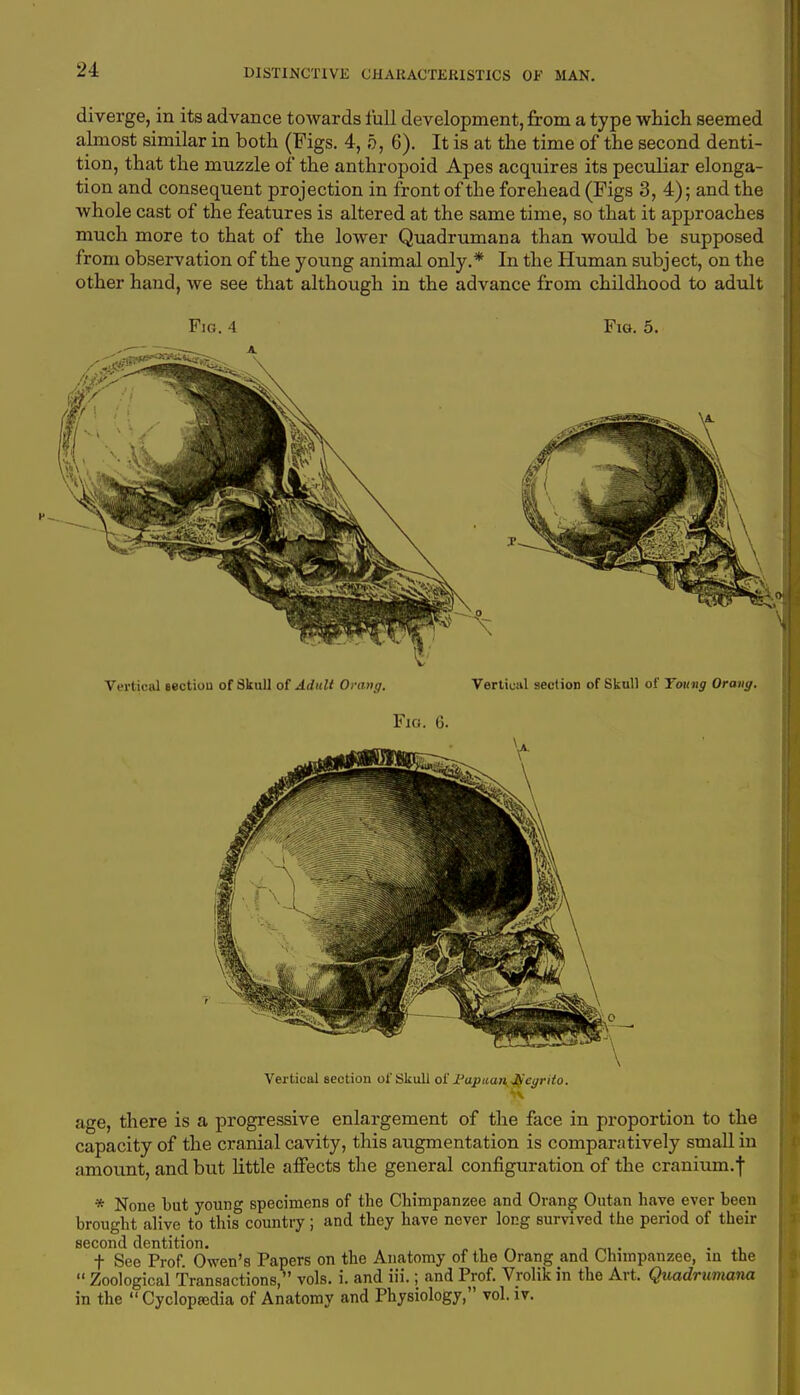 diverge, in its advance towards full development, from a type which seemed almost similar in both (Figs. 4, 5, 6). It is at the time of the second denti- tion, that the muzzle of the anthropoid Apes acquires its peculiar elonga- tion and consequent projection in front of the forehead (Pigs 3, 4); and the whole cast of the features is altered at the same time, so that it approaches much more to that of the lower Quadrumana than would be supposed from observation of the young animal only.* In the Human subject, on the other hand, we see that although in the advance from childhood to adult Fig. 4 Fig. 5. Vertical section of Skull of Adult Orang. Vertical section of Skull of Young Orong. Fig. 6. Vertical section of Skull of ^apuan^Jfegriio. age, there is a progressive enlargement of the face in proportion to the capacity of the cranial cavity, this augmentation is comparatively small in amount, and but little affects the general configuration of the cranium.f * None but young specimens of the Chimpanzee and Orang Outan have ever been brought alive to this country ; and they have never long survived the period of their second dentition. . t See Prof. Owen's Papers on the Anatomy of the Orang and Chimpanzee, in the  Zoological Transactions, vols. i. and in.; and Prof. Vrolik in the Art. Quadrumana in the Cycloptedia of Anatomy and Physiology, vol. iv.