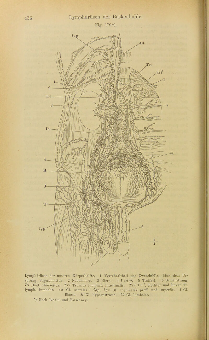 Fig. 179*). Lymphdrüsen der unteren Körperhälfte. 1 Vertebraltheil des Zwerchfells, über dem Ur- sprung abgeschnitten. 2 Nebenniere. 3 Niere. 4 Ureter. 5 Testikel. 6 Samenstrang. D( Duct. tlioracicus. Tri Truneus Ij'mphat. intestinalis. Trl^TrJ, Rechter und linker Tr. lymph. lumbalis. sa Gl. sacrales. igp, ig^ Gl. inguinales proff. und superfic. / Gl. üiacae. H Gl. hypogastricae. Ib Gl. lumbales. *) Nach Beau und Bonamy.