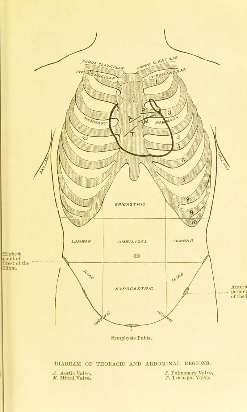 DIAGRAM OF TnOEACIC A, Aortic Valvo. M. Mitral Valve. AND ABDOMJNAT, KKGIONS. r. Pulmonary Vah o. T, Tricuspid Valve.