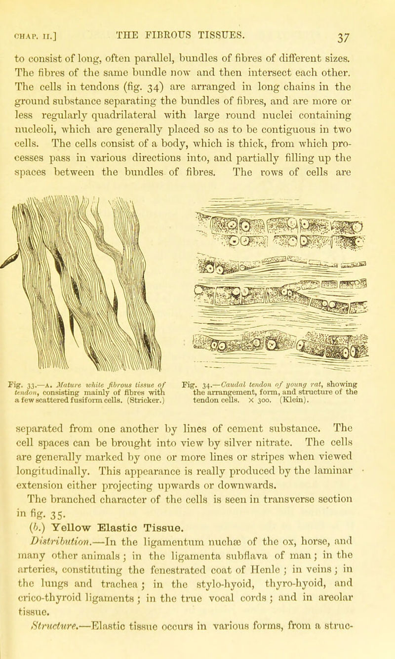 to consist of long, often parallel, bundles of fibres of diffei-ent sizes. The fibres of the same bundle now and then intersect each other. The cells in tendons (fig. 34) are arranged in long chains in the ground substance separating the bundles of fibres, and are more or less regularly quadrilateral with large round nuclei containing nucleoli, which are generally placed so as to be contiguous in two cells. The cells consist of a body, which is thick, from which pro- cesses pass in various directions into, and partially filling up the spaces between the bundles of fibres. The rows of cells are ^^g- 33-—A- Mature widte fibrous tissue of Fig'. 34.—Caudal tendon of young rat, showing ttndoii, consisting mainly of fibres with the arrangement, form, and structure of tlie a few scattered fusifoi-m cells. (Strieker.) tendon cells, x 300. (Klein). separated from one another by lines of cement substance. The cell spaces can be brought into view by silver nitrate. The cells are generally marked by one or moi'e lines or stripes when viewed longitudinally. This appearance is really produced by the laminar extension either projecting upwards or downwards. The branched character of the cells is seen in transverse section in fig- 35- {h.) YeUow Elastic Tissue. Distribution.—In the ligamentum nuchfe of the ox, horse, and many other animals; in the ligamenta subflava of man; in the arteries, constituting the fenestrated coat of Henle ; in veins j in the lungs and trachea; in the stylo-hyoid, thyro-hyoid, and crico-thyroid ligaments ; in the tiiie vocal cords ; and in areolar tissue. Structure.—Elastic tissue occurs in various forms, from a struc-