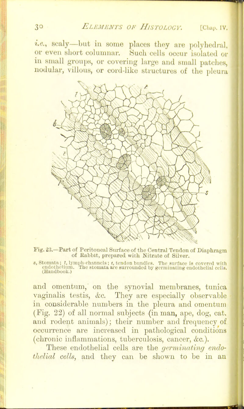 i.e., scaly—but in some places they are polyhedral, or even slioi't coluiimar-. Such cells occur isolated oi- in siuiiU groups, or covering large and small patches, nodular, villous, or cord-like structures of the pleura rig. 23.—Part of Peritoneal Siirface of the Central Tendon of Diaphragm of Kabbit, prepared with Nitrate of Silver. s, Storantn ; I, lymph-rh.-mnels; t, tendon bnndlos. The surf.ace is covered with cndothciiiini. The stomata are surrounded by germinating endothelial cells. CHandbook.) and omentum, on the synovial membranes, tunica vaginalis testis, kc. They are especially observable in considerable numbers in the pleura and omentum (Fig. 22) of all nonnal subjects (in man, ape, dog, cat, and I'odent animals); their number and frequency of occurrence are increased in pathological conditions (chronic inflammations, tuberculosis, cancer, ikc). These endothelial cells are the gprmimding endo- thelial cells, and they can be shown to be in au