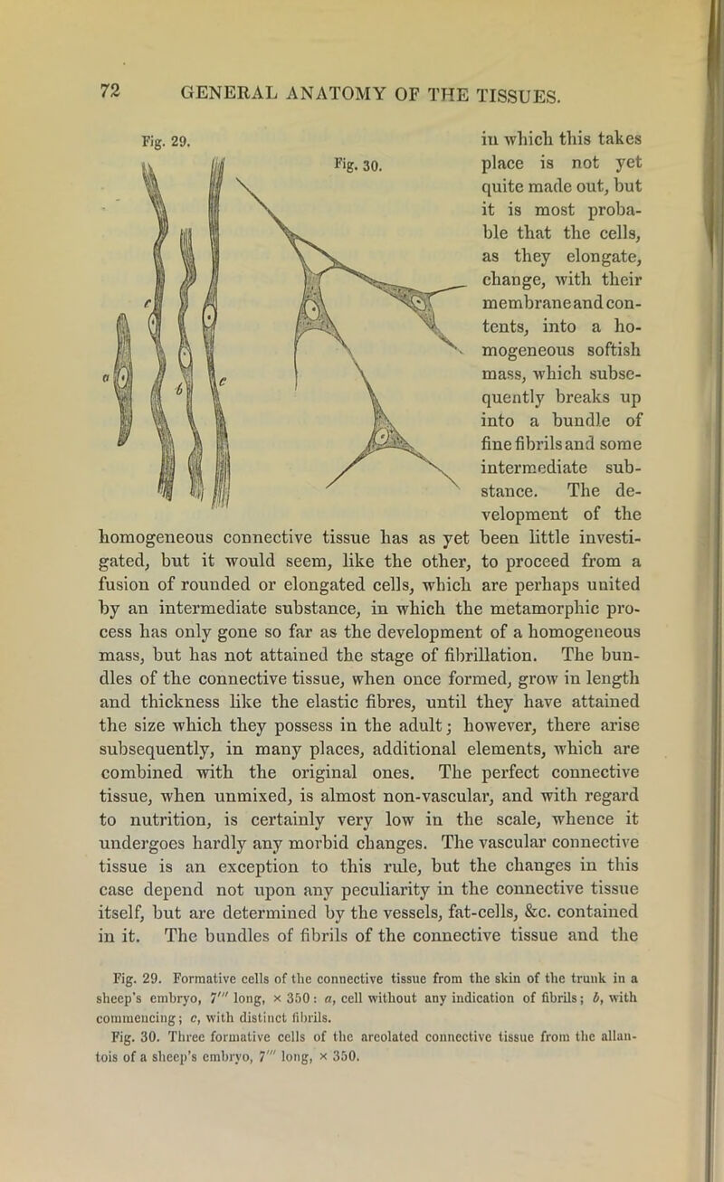 Fig. 30. Fig. 29. in which this takes place is not yet quite made out, but it is most proba- ble that the cells, as they elongate, change, with their membraneand con- tents, into a ho- mogeneous sottish mass, which subse- quently breaks up into a bundle of fine fibrils and some intermediate sub- stance. The de- velopment of the homogeneous connective tissue has as yet been little investi- gated, but it would seem, like the other, to proceed from a fusion of rounded or elongated cells, which are perhaps united by an intermediate substance, in which the metamorphic pro- cess has only gone so far as the development of a homogeneous mass, but has not attained the stage of fibrillation. The bun- dles of the connective tissue, when once formed, grow in length and thickness like the elastic fibres, until they have attained the size which they possess in the adult; however, there arise subsequently, in many places, additional elements, which are combined with the original ones. The perfect connective tissue, when unmixed, is almost non-vascular, and with regard to nutrition, is certainly very low in the scale, whence it undergoes hardly any morbid changes. The vascular connective tissue is an exception to this rule, but the changes in this case depend not upon any peculiarity in the connective tissue itself, but are determined by the vessels, fat-cells, &c. contained in it. The bundles of fibrils of the connective tissue and the Fig. 29. Formative cells of tlie connective tissue from the skin of the trunk in a sheep’s embryo, 7' long, x 350: a, cell without any indication of fibrils; b, with commencing; c, with distinct fibrils. Fig. 30. Three formative cells of the areolated connective tissue from the allan- tois of a sheep’s embryo, 7' long, x 350.