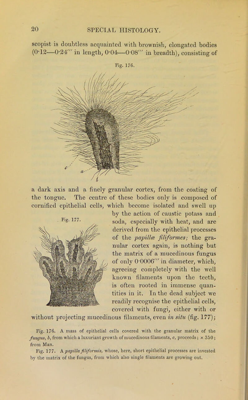 scopist is doubtless acquainted with brownish, elongated bodies (0-12—0-24' in length, 0-04—0-08' in breadth), consisting of Fig. 176. a dark axis and a finely granular cortex, from the coating of the tongue. The centre of these bodies only is composed of cornified epithelial cells, which become isolated and swell up by the action of caustic potass and soda, especially with heat, and are derived from the epithelial processes of the papillae filiformes; the gra- nular cortex again, is nothing but the matrix of a mucedinous fungus of only 0 0006' in diameter, which, agreeing completely with the well known filaments upon the teeth, is often rooted in immense quan- tities in it. In the dead subject we readily recognise the epithelial cells, covered with fungi, either with or without projecting mucedinous filaments, even in situ (fig. 177); Fig. 176. A mass of epithelial cells covered with the granular matrix of the fungus, b, from which a luxuriant growth of mucedinous filaments, c, proceeds; x 350 ; from Man. Fig. 177. A papilla filifurmis, whose, here, short epithelial processes are invested by the matrix of the fungus, from which also single filaments are growing out.