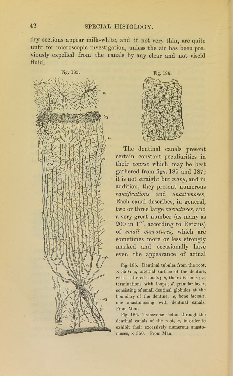 dry sections appear milk-white, and if not very thin, are quite unfit for microscopic investigation, unless the air has been pre- viously expelled from the canals by any clear and not viscid fluid. Fig. 185. Fig. 186. The dentinal canals present certain constant peculiarities in their course which may be best gathered from figs. 185 and 187; it is not straight but wavy, and in addition, they present numerous ramifications and anastomoses. Each canal describes, in general, two or three large curvatures, and a very great number (as many as 200 in 1', according to Ketzius) of small curvatures, which are sometimes more or less strongly marked and occasionally have even the appearance of actual Fig. 185. Dentinal tubules from the root, x 350: a, internal surface of the dentine, with scattered canals ; b, their divisions; e, terminations with loops ; d, granular layer, consisting of small dentinal globules at the boundary of the dentine; e, bone lacuna, one anastomosing with dentinal canals. From Man. Fig. 186. Transverse section through the dentinal canals of the root, a, in order to exhibit their excessively numerous anasto- moses, x 350. From Man.