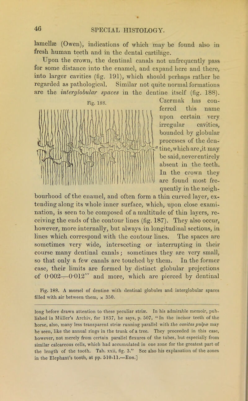 lamellae (Owen), indications of which may be found also in fresh human teeth and in the dental cartilage. Upon the crown, the dentinal canals not unfrequently pass for some distance into the enamel, and expand here and there, into larger cavities (fig. 191), which should perhaps rather be regarded as pathological. Similar not quite normal formations are the interglobular spaces in the dentine itself (fig. 188). Czermak has con- ferred this name upon certain very irregular cavities, bounded by globular processes of the den-  tine, which are ,it may be said, never entirely absent in the teeth. In the crown they are found most fre- quently in the neigh- bourhood of the enamel, and often form a thin curved layer, ex- tending along its whole inner surface, which, upon close exami- nation, is seen to be composed of a multitude of thin layers, re- ceiving the ends of the contour lines (fig. 187). They also occur, however, more internally, but always in longitudinal sections, in lines which correspond with the contour lines. The spaces are sometimes very wide, intersecting or interrupting in their course many dentinal canals; sometimes they are very small, so that only a few canals are touched by them. In the former case, their limits are formed by distinct globular projections of OOOS^-O'OIS' and more, which are pierced by dentinal Fig. 188. A morsel of dentine with dentinal globules and interglobular spaces filled with air between them, x 350. long before drawn attention to these peculiar striae. In his admirable memoir, pub- lished in Muller's Archiv, for 1837, he says, p. 507, In the incisor teeth of the horse, also, many less transparent striae running parallel with the cavitaspulpce may be seen, like the annual rings in the trunk of a tree. They proceeded in this case, however, not merely from certain parallel flexures of the tubes, but especially from similar calcareous cells, which had accumulated in one zone for the greatest part of the length of the tooth. Tab. xxii, fig. 3. See also his explanation of the zones in the Elephant's tooth, at pp. 510-11.—Eds.]