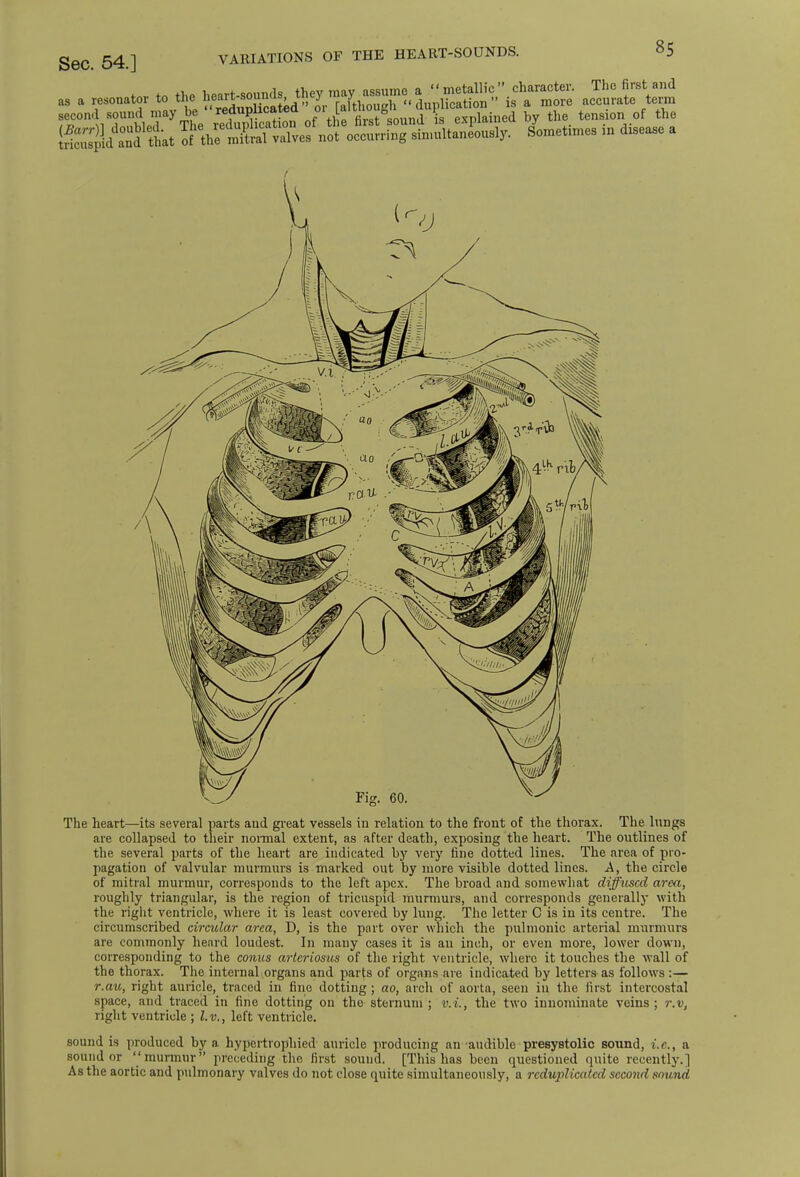 as a resonator to the heart-soundsthey may duplSS'^S' acta second sound may be  reduphcated '^^g^^^Ji Jy the tension of the ggfiSL ^^^r^^^^y. Sometimes in disease a The heart—its several parts and great vessels in relation to the front of the thorax. The lungs are collapsed to their normal extent, as after death, exposing the heart. The outlines of the several parts of the heart are indicated by very fine dotted lines. The area of pro- pagation of valvular murmurs is marked out by more visible dotted lines. A, the circle of mitral murmur, corresponds to the left apex. The broad and somewhat diffused area, roughly triangular, is the region of tricuspid murmurs, and corresponds generally with the right ventricle, where it is least covered by lung. The letter C is in its centre. The circumscribed circular area, D, is the part over which the pulmonic arterial murmurs are commonly heard loudest. In many cases it is an inch, or even more, lower down, corresponding to the conus arteriosus of the right ventricle, where it touches the wall of the thorax. The internal organs and parts of organs-are indicated by letters as follows :— r.au, right auricle, traced in fine dotting ; ao, arch of aorta, seen ill the first intercostal space, and traced in fine dotting on the sternum ; right ventricle ; l.v., left ventricle. v. %. the two innominate veins ; r.v, sound is produced by a hypertrophied auricle producing an-audible presystolic sound, i.e., a sound or murmur preceding the first sound. [This has been questioned quite recently.] As the aortic and pulmonary valves do not close quite simultaneously, a reduplicated second sound