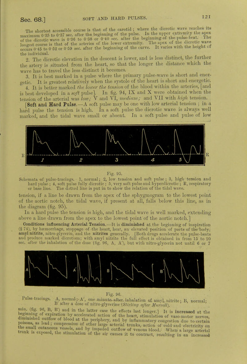 SOFT AND HARD PULSES. of the dicrotic wave is 036 to 0-38 or 0-40 sec. after the beginning of the pul longest course is that of the arteries of tl.e lower extremity. Ihe apex of the occurs 0-45 to 0 52 or 059 sec. after the beginning of the curve. It varies with The shortest accessible course is that of the carotid ; where the dicrotic wave reaches its 0 35 to 0-37 sec. after the beginning of tl.e pulse. In the upper extremity the apex 1 the pulse-beat. 1 lie he dicrotic wave ith the height of OCCUrS 11*40 10 0 02 or v ov set. curoi w» ft**ft — ■ -- ° the individual. 2. The dicrotic elevation in the descent is lower, and is less distinct, the further the artery is situated from the heart, so that the longer the distance which the wave has to travel the less distinct it becomes. 3. It is best marked in a pulse wliere the primary pulse-wave is short and ener- o-etic. It is greatest relatively when the systole of the heart is short and energetic. 4. It is better marked the lower the tension of the blood within the arteries, [and is best developed in a soft pulse]. In fig. 94, IX and X were obtained when the tension of the arterial was low; V and VI, medium; and ATII with high tension. [Soft and Hard Pulse.—A soft pulse may be one with low arterial tension ; in a hard pulse the tension is high. In a soft pulse the dicrotic wave is always well marked, and the tidal wave small or absent. In a soft pulse and pulse of low high tension and Fig. 95. Schemata of pulse-tracings. 1, normal; 2, low tension and soft pulse ; 3 hard pulse ; 4, soft pulse fully dicrotic ; 5. very soft pulse and hyperdicrotic ; B, respiratory or base line. The dotted line is put in to show the relation of the tidal wave. tension, if a line be drawn from the apex of the sphygmogram to the lowest point of the aortic notch, the tidal wave, if present at all, falls below this line, as in the diagram (fig. 95). In a hard pulse the tension is high, and the tidal wave is well marked, extending above a line drawn from the apex to the lowest point of the aortic notch.] Conditions influencing Arterial Tension.—It is diminished at the beginning of inspiration (§ 74), by hemorrhage, stoppage of the heart, heat, an elevated position of parts of the body; amyl nitrite, nitro-glycerin, and the nitrites generally. [Both drugs accelerate the pulse-beats and produce marked dicrotism; with amyl nitrite the full effect is obtained in from 15 to 20 sec. after the inhalation of the dose (fig. 96, A, A'), but with nitro-glycerin not until 6 or 7 Fig. 96. Pulse-tracings. A, normal; A', one minute, after inhalation of amvl. nitrite: B, normal; a alter a dose of mtro-glyocrine [Stirling after Murrcll). wLif,?/, !f6' B'-B?- af in th,C kttf Casc the e^cts ,ast lonSel-] lt ^ increased at the dSShfd^^LX^i^aC?el?rated .aCvti°n °f }h* heart> sti'»l'<tion of vaso-motor nerves, tS^uS^om™^? ?6+riiPhery' aml by i^mniatory- congestion due to certain tCSl Jtei^o^PreSf10U °,f10thei'la>p arterial trunks, action of cold and electricity on the small cutaneous vessels and by impeded outflow of venous blood. When a large arterial trunk is exposed, the stimulation of the air causes it to contract, resulting in a/incS