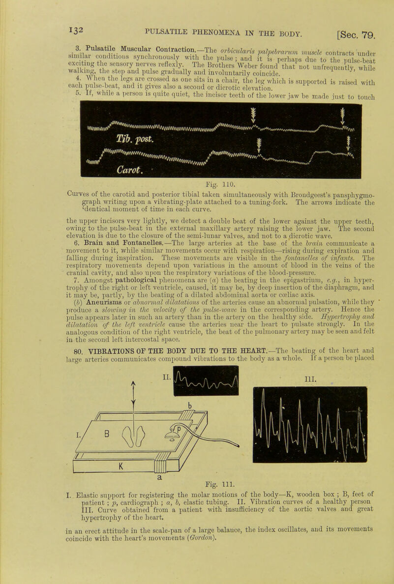 3 Pulsatile Muscular Contraction -The orbicularis palpebrarum muscle contracts under similar conditions synchronously with the pulse; and it is perhaps due to the pulseS exciting t he sensory nerves reflexly. The Brothers Weber found that not unfVem.ent y w ile walking, tie' step and pulse gradually and involuntarily coincide Y' i When the legs are crossed as one sits in a, chair, the leg which is supported is raised with ea.-h pulsc-hcat, and it gives also a second or dicrotic elevation. 5. If, while a person is quite quiet, the incisor teeth of the lower jaw be made just to touch Tib. fost. * | Carot. fig. 110. Curves of the carotid and posterior tibial taken simultaneously with Brondgeest's pansphygmo- graph writing upon a vibrating-plate attached to a tuning-fork. The arrows indicate the identical moment of time in each curve. the upper incisors very lightly, we detect a double beat of the lower against the upper teeth, owing to the pulse-beat in the external maxillary artery raising the lower jaw. The second elevation is due to the closure of the semi-lunar valves, and not to a dicrotic wave. 6. Brain and FontaneUes.—The large arteries at the base of the brain communicate a movement to it, while similar movements occur with respiration—rising during expiration and falling during inspiration. These movements are visible in the fontanelles of infants. The respiratory movements depend upon variations in the amount of blood in the veins of the cranial cavity, and also upon the respiratory variations of the blood-pressure. 7. Amongst pathological phenomena are (a) the beating in the epigastrium, e.g., in hyper- trophy of the right or left ventricle, caused, it may be, by deep insertion of the diaphragm, and it may be, partly, by the beating of a dilated abdominal aorta or coeliac axis. (b) Aneurisms or abnormal dilatations of the arteries cause an abnormal pulsation, while they produce a slowing in the velocity of the pulse-wave in the corresponding artery. Hence the pulse appears later in such an artery than in the artery on the healthy side. Hypertrophy and dilatation of the left ventricle cause the arteries near the heart to pulsate strongly. Iu the analogous condition of the right ventricle, the beat of the pulmonary artery may be seen and felt in the second left intercostal space. 80. VIBRATIONS OF THE BODY DUE TO THE HEART.—The beating of the heart and large arteries communicates compound vibrations to the body as a whole. If a person be placed III. I. Elastic support for registering the molar motions of the body—K, wooden box ; B, feet of patient ; p, cardiograph ; a, b, elastic tubing. II. Vibration curves of a healthy person III. Curve obtained from a patient with insufficiency of the aortic valves and great hypertrophy of the heart. in an erect attitude in the scale-pan of a large balance, the index oscillates, and its movements coincide with the heart's movements (Gordon).