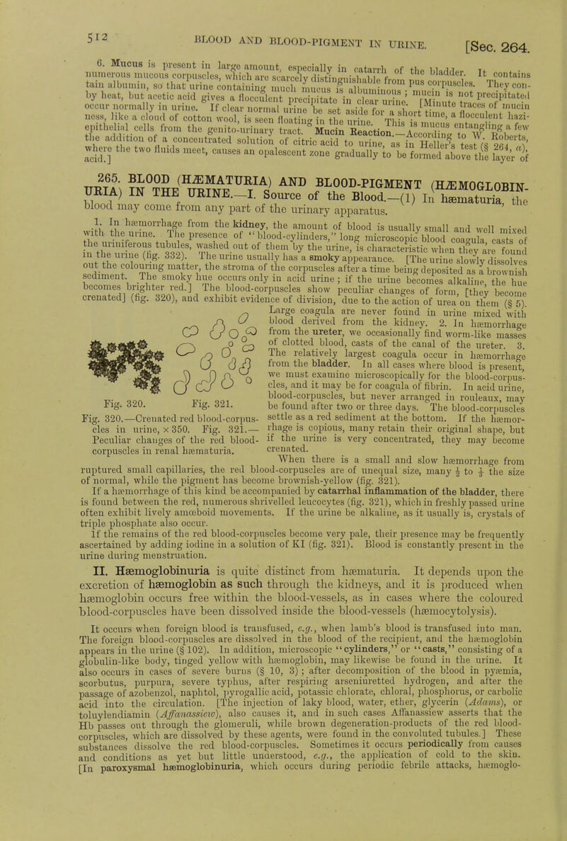 6. Mucus is present in large amount, especially in catarrh of Vh* i numerous mucous corpuscles, which are scarcely distinJ uM \l L 14 C01'tais tain albumin, so that urine containing nmch mucu TSbum?, on, PS C01'l,uscles- T^y con- by heat, but acetic acid givea a SccLT^^if^^' Ei tSf^' occur normal y in urine. If clear normal i, .|„„ u~ • i <■ UI1^ iiviinute tiaces ol mucin liess, like a cloud of O^^SS^fSS^Jt the nrbfp Tl ^ ^ a ll0CCllle,,t hazi epithelial cells from the geSuXy Hf the addition of a concentrated solution of citric acid to urine, as in HeSs tartrtaKv1 S3 tW° HUKlS meCt' C!U1SeS an °Palesce«t «» gradually to be fomed aboye tlie laye'r of Uml\ ?^°?^(Ht^t^TU?Ac) AND BLOOD-PIGMEIT (HEMOGLOBIN- URIA) IN THE UKINB.-I. Source of the Blood.-(l) l! hematuria, the blood may come from any part of the urinary apparatus. ■li J.? hffimorrhage from the kidney, the amount of blood is usually small and well mixed with the urine The presence of «<blood-cylinders, long microscopic blood coa'ula casts o the unniierous tubu es, washed out of them by the urine, is characteristic when Kyare found in the urine (hg. 332 The urine usually has a smoky appearance. [The urine!Sjd»oh out the colouring matter, the stroma of the corpuscles after a time being deposited as Ib o3 sediment The smoky hue occurs only in acid urine ; if the urine becomes alkaline, the hue becomes brighter red.] The blood-corpuscles show peculiar changes of form rthey become crenated] (fig. 320), and exhibit evidence of division/due to the action of urea on them (§ 5) Large coagula are never found in urine mixed with blood derived from the kidney. 2. In haemorrhage from the ureter, we occasionally find worm-like masses of clotted blood, casts of the canal of the ureter. 3. The relatively largest coagula occur in ha>morrha°-e from the bladder. In all cases where blood is present, we must examine microscopically for the blood-corpus- cles, and it may be for coagula of fibrin. In acid urine, blood-corpuscles, but never arranged in rouleaux, may tig. 320. JJig. 321. be found after two or three days. The blood-corpuscles Fig. 320.—Crenated red blood-corpus- settle as a red sediment at the bottom. If the, hsemor- cles in urine, x 350. Fig. 321.— J'hage is copious, many retain their original shape, but Peculiar changes of the red blood- if the urine is very concentrated, they may become corpuscles in renal hematuria, crenated. When there is a small and slow hemorrhage from ruptured small capillaries, the red blood-corpuscles are of unequal size, many \ to \ the size of normal, while the pigment has become brownish-yellow (fig. 321). If a haemorrhage of this kind be accompanied by catarrhal inflammation of the bladder, there is found between the red, numerous shrivelled leucocytes (fig. 321), which in freshly passed urine often exhibit lively amoeboid movements. If the urine be alkaline, as it usually is, crystals of triple phosphate also occur. If the remains of the red blood-corpuscles become very pale, their presence may be frequently ascertained by adding iodine in a solution of KI (fig. 321). Blood is constantly present in the urine during menstruation. II. Hemoglobinuria is quite distinct from hematuria. It depends upon the excretion of haemoglobin as such through the kidneys, and it is produced when haemoglobin occurs free within the blood-vessels, as in cases where the coloured blood-corpuscles have been dissolved inside the blood-vessels (haemocytolysis). It occurs when foreign blood is transfused, e.g., when lamb's blood is transfused into man. The foreign blood-corpuscles are dissolved in the blood of the recipient, and the hiemoglobiu appears in the urine (§ 102). In addition, microscopic cylinders, or casts, consisting of a globulin-like body, tinged yellow with haemoglobin, may likewise be found in the urine. It also occurs in cases of severe burns (§ 10, 3); after decomposition of the blood in pyaemia, scorbutus, purpura, severe typhus, after respiring arscniuretted hydrogen, and after the passage ofazobenzol, naphtol, pyrogallic acid, potassic chlorate, chloral, phosphorus, or carbolic acid into the circulation. [The injection of laky blood, water, ether, glycerin (Adams), or toluylendiamin (Affanassicio), also causes it, and in such cases AH'anassicw asserts that the Hb passes out through the glomeruli, while brown degeneration-products of the red blood- corpuscles, which are dissolved by these agents, were found in the convoluted tubules.] These substances dissolve the red blood-corpuscles. Sometimes it occurs periodicaUy from causes and conditions as yet but little understood, e.g., the application of cold to the skin. [In paroxysmal hemoglobinuria, which occurs during periodic febrile attacks, luemoglo-