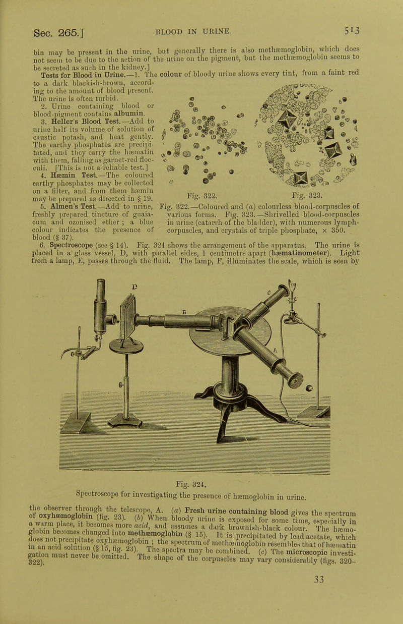 bin may be present in the urine, but generally there is also methremoglnbin, which does not seem to be due to the action of the urine on the pigment, but the methaemoglobiii seems to be secreted as such in the kidney.] . . Tests for Blood in Urine.—1. The colour of bloody urine shows every tint, lrom a taint red to a dark blackish-brown, accord- ing to the amount of blood present The urine is often turbid. 2. Urine containing blood or blood-pigment contains albumin. 3. Heller's Blood Test.—Add to urine half its volume of solution of caustic potash, and heat gently. The earthy phosphates are precipi- tated, and they carry the hamiatiu with tlicni, falling as garnet-red floc- culi. [This is nor, a reliable test.] 4. Hffimin Test.—The coloured earthy phosphates may be collected on a filter, and from them hfemin may be prepared as directed in § 19. 5. Almen's Test.—Add to urine, freshly prepared tincture of gtiaia- cuin and ozonised ether ; a blue colour indicates the presence of blood (§ 37). 6. Spectroscope (see § 14). Fig. 324 shows the arrangement of the apparatus. The urine is placed in a glass vessel, D, with parallel sides, 1 centimetre apart (hsematinometer). Light from a lamp, E, passes through the fluid. The lamp, F, illuminates the scale, which is seen by Fig. 323. Fig. 322.—Coloured and (a) colourless blood-corpuscles of various forms. Fig. 323.—Shrivelled blood-corpuscles in urine (catarrh of the bladder), with numerous lyniph- corpuscles, and crystals of triple phosphate, x 350. Fig. 324. Spectroscope for investigating the presence of haemoglobin in urine. To^Z^Z^Vf^wt fr> Tr68h Urine ContaininS blood gives the spectrum 01 oxyn»mogioDin (tig. 23). (b) When bloody urine is exposed for some time esne.'iallv in 33