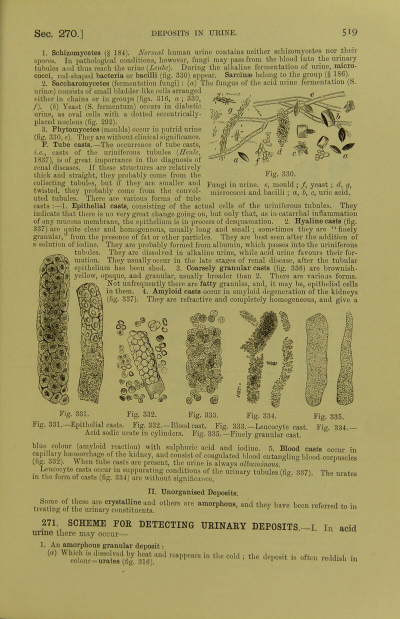 1. Schizomycetes (§ 184). Normal human urine contains neither schizomycetes nor their spores. In pathological conditions, however, fungi may pass from the blood into the urinary tubules and thus reach the urine (Lcubc). During the alkaline fermentation of urine, micro- cocci, rod-shaped bacteria or bacilli (tig. 330) appear. Sarcinro belong to the group (§ 186). 2. Saccharomycetes (fermentation fungi): (a) The fungus of the acid urine fermentation (S. urinaj) consists of small bladder-like cells arranged either in chains or in groups ((igs. 316, a ; 330, /). (b) Yeast (S. fermentum) occurs in diabetic urine, as oval cells with a clotted eccentrically- placed nucleus (fig. 292). 3. Phytomycetes (moulds) occur in putrid urine (fig. 330, e). They are without clinical significance. F. Tube casts.—The occurrence of tube casts, i.e., casts of the uriniferous tubules (Hcnlc, 1837), is of great importance in the diagnosis of renal diseases. If these structures are relatively thick and straight, they probably come from the collecting tubules, but if they are smaller and twisted, they probably come from the convol- uted tubules. There are various forms of tube casts :—1. Epithelial casts, consisting of the actual cells of the uriniferous tubules. They indicate that there is no very great change going on, but only that, as in catarrhal inflammation of uny mucous membrane, the epithelium is in process of desquamation. 2. Hyaline casts (fig. 337) are quite clear and homogeneous, usually long and small ; sometimes they are  finely granular, from the presence of fat or other particles. They are best seen alter the addition of a solution of iodine. They are probably formed from albumin, which passes into the uriniferous tubules. They are dissolved in alkaline urine, while acid urine favours their for- mation. They usually occur in the late stages of renal disease, after the tubular epithelium has been shed. 3. Coarsely granular casts (fig. 336) are brownish- yellow, opaque, and granular, usually broader than 2. There are various forms. Not unfrequently there are fatty granules, and, it may be, epithelial cells in them. 4. Amyloid casts occur in amyloid degeneration of the kidneys They are refractive and completely homogeneous, and give a Fig. 330. Fungi in urine, e, mould ; /, yeast; d, g, micrococci and bacilli; a, b, c, uric acid. ; a|p mm Fiff. 331. Fig. 332. Fig. 333. Fig. 334. Fig. 335.  <■>- * *&• tig. 331.—Epithelial casts. Fig. 332.—Blood cast. Fig. 333.—Leucocyte cast. Fi<*. 334 — Acid sodic urate in cylinders. Fig. 335.—Finely granular cast. blue colour (amyloid reaction) with sulphuric acid and iodine. 5. Blood casts occur in capillary hemorrhage of the kidney, and consist of coagulated blood entangling blood-corpuscles (ng. 332j. When tube casts are present, the urine is always albuminous Leucocyte casts occur in suppurating conditions of the urinary tubules (fig. 337). The urates in the form of casts (fig. 334) are without significance. • II. Unorganised Deposits. Some of these are crystalline and others are amorphous, and they have been referred to in treating of the urinary constituents. J 10 111 271. SCHEME FOR DETECTING URINARY DEPOSITS —I In acid urine there may occur— 1. An amorphous granular deposit • W WUturf SSflg 3ei6).,iml rCaPPea1'8  t,,G C0U15 th6 dt*08it is «« reddish in