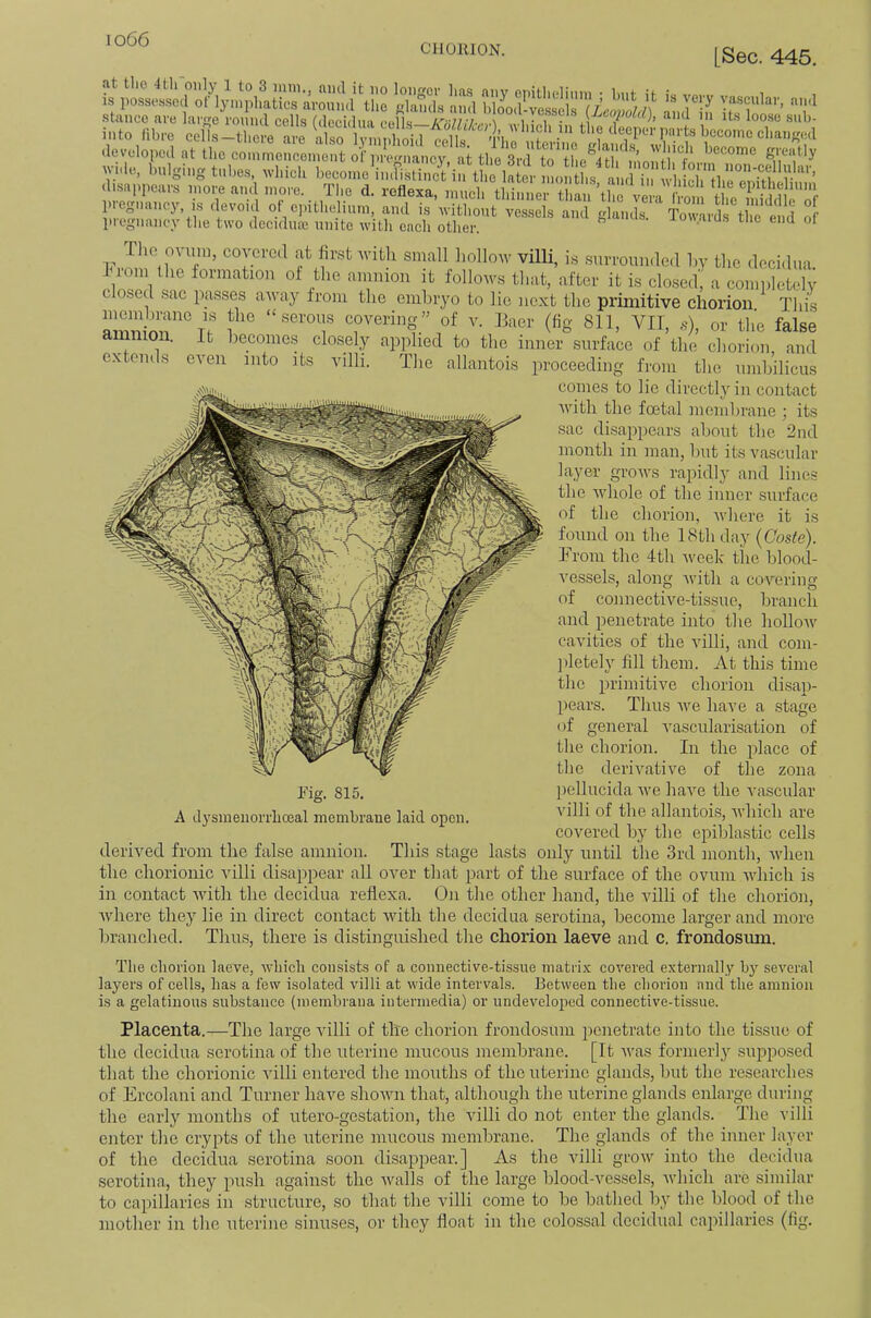 cnoiuoN. [Sec. 445. is l»ss,ssca onjnlplf.Jir;™ siS's I'ml T* developed at the coimnencenient oi‘])i-e>,oiancy, at the 3rd to tlie^4th innii''t!'V g'^d'y w ,U, bulging tubes, wbieb boeouie^udistiucViS t i? • So ,s n i dl' disappears more and .nore._ Tl.e d. reflexa, nmeb tbinne, Jj.a.^tbe Vera K the SS? Sf piegiiauey, IS devoid of epitbelium, and is witliout vessels and glands. Towards the end of piegnaney tlie two decidutc unite with each otlier. ' ° ^ f villi, is suiTounde.l liy tlic decidua, l iom tlie formation of the ammon it follows that, after it is closed, a completely osed sac passes away from the embryo to lie next the primitive chorion This alSSn nn” f' “^evoxxs covering” of a'. Baer (fig 811, VII, s), or the false amnion. It becomes closely ap])lied to the inner surface of the chorion, and extends ci^en into its villi. The allantois proceeding from the umbilicus conies to lie directly in contact Avith the foetal membrane ; its sac disappears about the 2nd month in man, but its vascular layer groAvs rapidly and lines the Avhole of the inner surface of the chorion, Avhere it is found on the 18th day (Coste). From the 4th Aveek the blood- A^essels, along Avith a coAmring of connective-tissue, branch and penetrate into the holloAv caAuties of the villi, and com- ])letely fill them. At this time the primitive chorion disap- pears. Thus Ave have a stage of general A'ascularisation of the chorion. In the place of the derivative of the zona Fig. 815. pellucida Ave liaA’-e the vascular A dysmenorrlioeal membrane laid open. allantois, Avhich are covered by the epiblastic cells derived from the false amnion. This stage lasts only until the 3rd month, Avhen the chorionic villi disappear all over that part of the surface of the ovum AAdiich is in contact Avith the decidua reflexa. On the other hand, the villi of the chorion, Avhere they lie in direct contact Avith the decidua serotina, become larger and more branched. Thus, there is distinguished the chorion laeve and c. frondosum. The chorion laeve, aaFicIi consists of a connective-tissue matrix covered externally by seA'eral layers of cells, has a few isolated villi at wide intervals. BetAveen the chorion and the amnion is a gelatinous substance (membrana intermedia) or undeA^eloped connective-tissue. Placenta.—The large auIK of the chorion frondosum penetrate into the tissue of the decidua serotina of the uterine mucous membrane. [It Avas formerl}’' sujAposed that the chorionic villi entered the mouths of the uterine glands, but the researches of Ercolani and Turner have shoAAm that, although the uterine glands enlarge during the early months of utero-gestation, the villi do not enter the glands. The villi enter the crypts of the uterine mucous membrane. The glands of the inner layer of the decidua serotina soon disappear.] As the Aulli groAv into the decidua serotina, they piish against the Avails of the large blood-A'^essels, Avliich are similar to capillaries in structure, so that the A'illi come to be bathed by the blood of the mother in the uterine sinuses, or they float in the colossal decidual capillaries (fig.