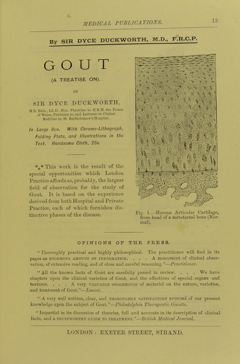 MEDIC A L PUB Lie A TIONS. By SIR DYCE DUCKWORTH, M.D., F?R.C.P. GOUT (A TREATISE ON). BY SIR DYOE DUCKWORTH, M.D. Eclin., LL.D., lion. Physician to II.R.H. the Prince of Waies, Physician to, and Lecturer on Clinicai Medicine in, St. Bartholomew’s Hospital. In Large 8uo. With Chromo-Lithograph, Folding Plate, and Illustrations in the Text. Handsome Cloth, 25s. This work is the result of the special opportunities which London Practice affords as, probably, the largest field of observation for the study of Gout. It is based on the experience derived from both Hospital and Private Practice, each of which furnishes dis- tinctive phases of the disease. Fig. 1.—Human Articular Cartilage, from head of a metatarsal bone (Nor- mal). OPINIONS OF THE PRESS. “Thoroughly practical and highly philosophical. The practitioner will find in its pages an enormous amount of information. ... A monument of clinical obser- vation, of extensive reading, and of close and careful reasoning.”—Practitioner. “All the known facts of Gout are carefully passed in review. . . . We have chapters upon the clinical varieties of Gout, and the affections of special organs and textures. ... A very valuable storehouse of material on the nature, varieties, and treatment of Gout.”—Lancet. “A very well written, clear, and thoroughly satisfactory epitome of our present knowledge upon the subject of Gout.”—Philadelphia Therapeutic Gazette. “ Impartial in its discussion of theories, full aud accurate in its description of clinical facts, and a trustworthy gdide to treatment.”—British Medical Journal.