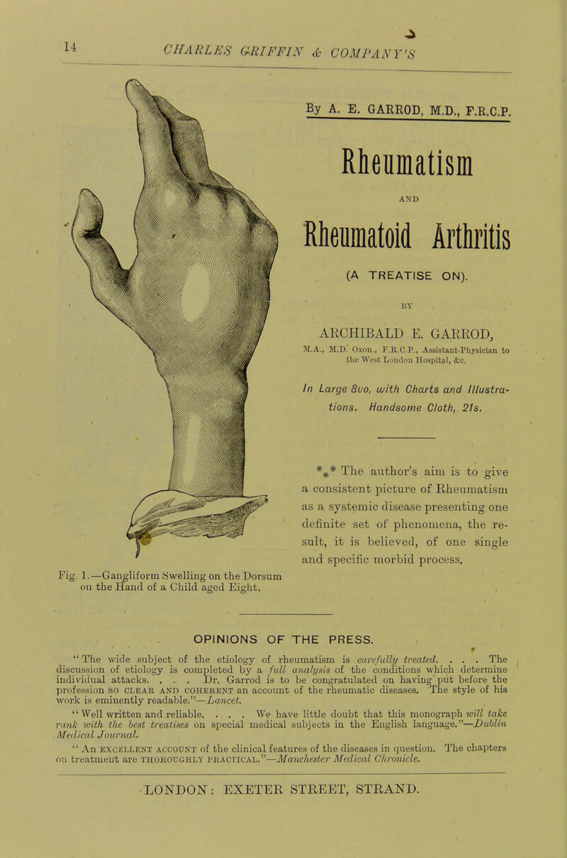 Fig. 1.—Gangliform iSwelling on the Dorsum on the Hand of a Child aged Eight. By A. E. GARROD, M.D., F.R.C.P. Rheumatism AND Rheumatoid Arthritis (A TREATISE ON). DY AECHIBALD E. GAEROD, M.A., M.D. Oxon., F.R.C.P., Assistant-Physician to the West London Hospitsil, &c. In Large 8uo, with Charts and Illustra- tions. Handsome Cloth, 21s. *^* The author’s aim is to give a consistent picture of Rheumatism as a systemic disease presenting one definite set of phenomena, the re- sult, it is believed, of one single and specific morbid process. OPINIONS OF THE PRESS.  The wide subject of the etiology of rheumatism is carefully treated. . . . The discussion of etiology is completed by a full analysis of the conditions which determine individual attacks. . . . Dr. Garrod is to be congratulated on having’put before the profession so clear and coherent an account of the rheumatic diseases. The style of his work is eminently readable.”—Lancet. “ Well written and reliable. . . . We have little doubt that this monograph will take rank with the best treatises on special medical subjects in the English language.”—Dublin Medical Journal. “ An E.XCELLENX ACCOUNT of the clinical features of the diseases in question. The chapters on treatment are thoroughly practical.”—Manchester Medical Chronicle.
