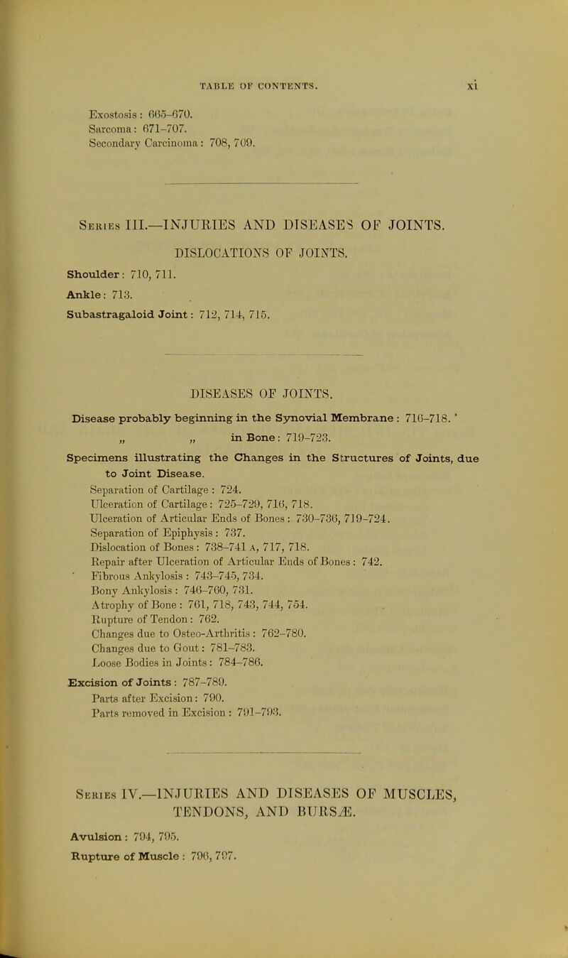 Exostosis: 665-670. Sarcoma: 671-707. Secondary Carcinoma: 708, 709. Series III.—INJURIES AND DISEASES OF JOINTS. DISLOCATIONS OF JOINTS. Shoidder: 710, 711. Ankle: 713. Subastragaloid Joint: 712, 714, 715. DISEASES OF JOINTS. Disease probably beginning in the S3movial Membrane : 71G-718. * „ „ in Bone: 719-723. Specimens illustrating the Changes in the Structures of Joints, due to Joint Disease. Separation of Cartilage : 724. Ulceration of Cartilage: 725-729, 716, 718. Ulceration of Articalar Ends of Bones: 730-736, 719-724. Separation of Epiphysis : 737. Dislocation of Bones : 738-741 A, 717, 718. Repair after Ulceration of Articular Ends of Bones : 742. Fibrous Ankylosis : 743-745, 734. Bony Ankylosis : 746-760, 731. Atrophy of Bone : 761, 718, 743, 744, 754. Rupture of Tendon: 762. Changes due to Osteo-Arthritis : 762-780. Changes due to Gout: 781-783. Loose Bodies in Joints: 784-786. Excision of Joints : 787-789. Pai-ts after Excision: 790. Parts removed in Excision : 791-793. Sekies IV.—INJURIES AND DISEASES OF MUSCLES, TENDONS, AND BURS.^. Avulsion : 794, 795. Rupture of Mtiscle : 796, 797.