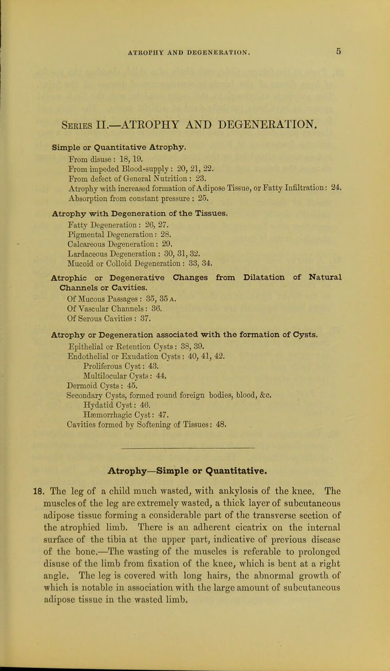 Seeies II.—ATKOPHY and DEGENEKATION. Simple or Quantitative Atrophy. From disuse : 18, 19. From impeded Blood-supply ; 20, 21, 22. Fi'om defect of General Nuti-ition : 23, Ati'ophy with increased formation of Adipose Tissue, or Fatty Infiltration: 24. Absorption from constant pressure : 25. Atrophy with Degeneration of the Tissues. Fatty Degeneration: 26, 27. Pigmental Degeneration: 28. Calcai-eous Degeneration: 29. Lardaceous Degeneration : 30, 31, 32. Mucoid or Colloid Degeneration : 33, 34. Atrophic or Degenerative Changes from Dilatation of Natural Channels or Cavities. Of Mucous Passages : 35, 35 a. Of Vascular Channels: 36. Of Serous Cavities : 37. Atrophy or Degeneration associated with the formation of Cysts, Epithelial or Eetention Cysts : 38, 39, Endothelial or Exudation Cysts; 40, 41, 42. Proliferous Cyst: 43. Multilocular Cysts: 44. Dermoid Cysts: 45, Secondary Cysts, formed round foreign bodies, blood, &c. Hydatid Cyst: 46. Hsemorrhagic Cyst: 47. Cavities formed by Softening of Tissues: 48. Atrophy—Simple or Quantitative. 18. The leg of a child much wasted, -with ankylosis of the knee. The muscles of the leg are extremely wasted, a thick layer of subcutaneous adipose tissue forming a considerable part of the transverse section of the atrophied limb. There is an adherent cicatrix on the internal surface of the tibia at the upper pai't, indicative of previous disease of the bone.—The wasting of the muscles is referable to prolonged disuse of the limb from fixation of the knee, which is bent at a right angle. The leg is covered with long hairs, the abnormal growth of which is notable in association with the large amount of subcutaneous adipose tissue in the wasted limb.