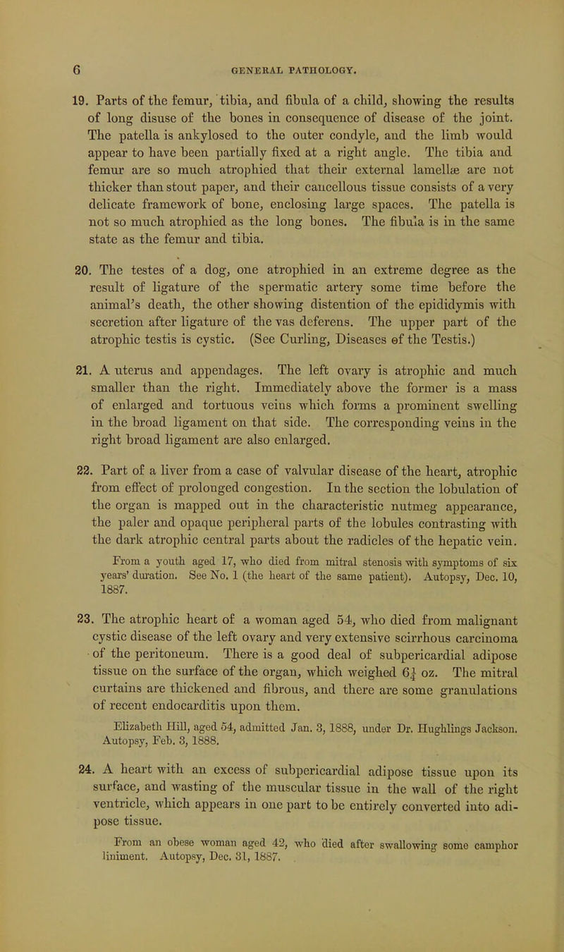 19. Parts of tte femur/tibiaj and fibula of a child, showing the results of long disuse o£ the bones in consequence of disease of the joint. The patella is ankylosed to the outer condyle, and the limb would appear to have been partially fixed at a right angle. The tibia and femur are so much atrophied that their external lamellae are not thicker than stout paper, and their cancellous tissue consists of a very delicate framework of bone, enclosing large spaces. The patella is not so much atrophied as the long bones. The fibula is in the same state as the femur and tibia. 20. The testes of a dog, one atrophied in an extreme degree as the result of ligature of the spermatic artery some time before the animal's death, the other showing distention of the epididymis with secretion after ligature of the vas deferens. The upper part of the atrophic testis is cystic. (See Curling, Diseases ef the Testis.) 21. A uterus and appendages. The left ovary is atrophic and much smaller than the right. Immediately above the former is a mass of enlarged and tortuous veins which forms a prominent swelling in the broad ligament on that side. The corresponding veins in the right broad ligament are also enlarged. 22. Part of a liver from a case of valvular disease of the heart, atrophic from eff'ect of prolonged congestion. In the section the lobulation of the organ is mapped out in the characteristic nutmeg appearance, the paler and opaque peripheral parts of the lobules contrasting with the dark atrophic central parts about the radicles of the hepatic vein. From a youth aged 17, who died from mitral stenosis with symptoms of six years' dm-ation. See No. 1 (the heart of the same patient). Autopsy, Dec. 10, 1887. 23. The atrophic heart of a woman aged 54, who died from malignant cystic disease of the left ovary and very extensive scirrhous carcinoma of the peritoneum. There is a good deal of subpericardial adipose tissue on the surface of the organ, which Aveighed 6| oz. The mitral curtains are thickened and fibrous, and there are some granulations of recent endocarditis upon them. Elizabeth Hill, aged 54, admitted Jan. 3,1888, under Dr. Hughlings Jackson. Autopsy, Feb. 3, 1888. 24. A heart with an excess of subpericardial adipose tissue upon its surface, and wasting of the muscular tissue in the wall of the right ventricle, which appears in one part to be entirely converted into adi- pose tissue. From an obese woman aged 42, who died after swallowing some camphor liaiment, Autopsy, Dec. 31, 1887.