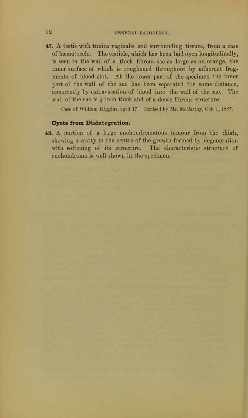 47. A testis with tunica vaginalis and surrounding tissues^ from a case of hsematocele. The testicle, which has been laid open longitudinally, is seen in the wall of a thick fibrous sac as large as an orange, the inner surface of which is roughened throughout by adherent frag- ments of blood-clot. At the lower part of the specimen the inner part of the wall of the sac has been separated for some distance, apparently by extravasation of blood into the wall of the sac. The wall of the sac is ^ inch thick and of a dense fibrous structure. Case of William Higgins, aged 17. Excised by Mr. McCarthy, Oct. 1, 1887. Cysts from Disintegration. 48. A portion of a large enchondromatous tumour from the thigh, showing a cavity in the centre of the growth formed by degeneration with softening of its structure. The characteristic structure of enchondroma is well shown in the specimen.