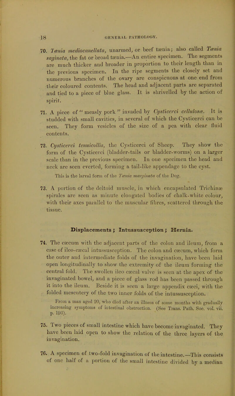 70. Jcenia mediocanellata, unarmed, or beef taenia; also called Tcenia saginata, the fat or broad tfenia.—An entire specimen. The segments are much thicker and broader in proportion to their length than in the previous specimen. In the ripe segments the closely set and numerous branches of the ovary are conspicuous at one end from their coloured contents. The head and adjacent parts are separated and tied to a piece of blue glass. It is shrivelled by the action of spirit. 71. A piece of  measly porlc  invaded by Cysticerci cellulosa;. It is studded with small cavities, in several of which the Cysticerci can be seen. They form vesicles of the size of a pea with clear fluid contents. 72. Cysticerci tenuicollis, the Cysticerci of Sheep. They show the form of the Cysticerci (bladder-tails or bladder-worms) on a larger scale than in the previous specimen. In one specimen the head and neck are seen everted, forming a tail-like appendage to the cyst. This is the larval fonn of the Teenia marginata of the Dog. 73. A portion of the deltoid muscle, in wliich encapsulated Trichinae spirales are seen as minute elongated bodies of chalk-white colour, with their axes parallel to the muscular fibres, scattered through the tissue. Displacements ; Intussusception; Hernia. 74. The caecum witli the adjacent parts of the colon and ileum, from a case of ileo-oajcal intussusception. The colon and caecum, which form the outer and intermediate folds of the invagination, have been laid open longitudinally to show the extremity of the ileum forming the central fold. The swollen ileo cajcal valve is seen at the apex of the invaginated bowel, and a piece of glass rod has been passed through it into the ileum. Beside it is seen a large appendix cseci, with the folded mesentery of the two inner folds of the intussusception. From a man aged 20, who died after an illness of some months with gi-adually increasing symptoms of intestinal obstruction. (See Trans. Path. Soe. vol. vil p. 193). 75. Two pieces of small intestine which have become invaginated. They have been laid open to show the relation of the three layers of the invagination. 76. A specimen of two-fold invagination of the intestine.—This consists of one half of a portion of the small intestine divided by a median