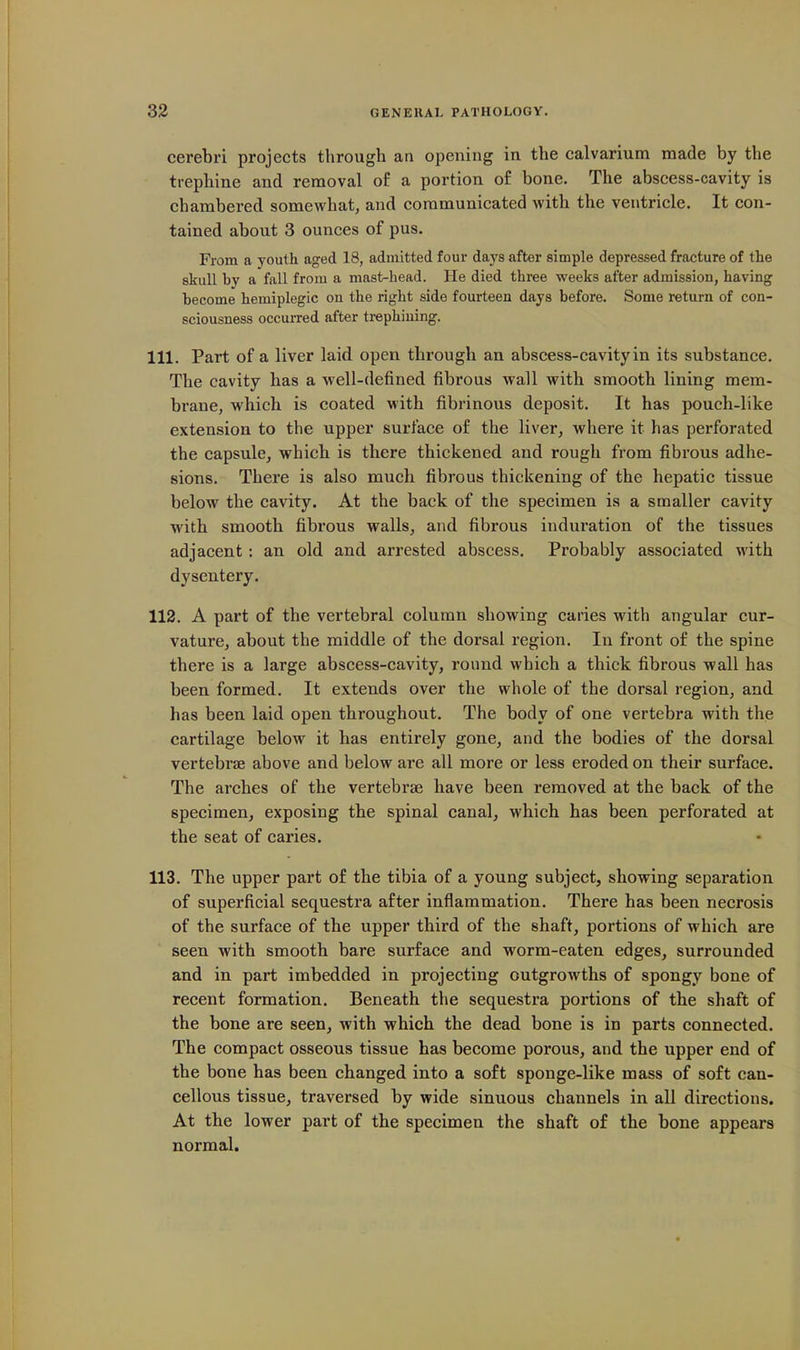 cerebri projects through an opening in the calvarium made by the trepbine and removal of a portion o£ bone. The abscess-cavity is chambered somewhat, and communicated with the ventricle. It con- tained about 3 ounces of pus. From a youth aged 18, admitted four days after simple depressed fracture of the skull by a fall from a mast-head. He died three weeks after admission, having become hemiplegic on the right side fourteen days before. Some return of con- sciousness occurred after trephining. 111. Part of a liver laid open through an abscess-cavity in its substance. The cavity has a well-defined fibrous wall with smooth lining mem- brane, which is coated with fibrinous deposit. It has pouch-like extension to the upper surface of the liver, where it has perforated the capsule, whicb is there thickened and rough from fibrous adhe- sions. There is also much fibrous thickening of the hepatic tissue below the cavity. At the back of the specimen is a smaller cavity with smooth fibrous walls, and fibrous induration of the tissues adjacent: an old and arrested abscess. Probably associated with dysentery. 112. A part of the vertebral column showing caries with angular cur- vature, about the middle of the dorsal region. In front of the spine there is a large abscess-cavity, round which a thick fibrous wall has been formed. It extends over the whole of the dorsal region, and has been laid open throughout. The body of one vertebra with the cartilage below it has entirely gone, and the bodies of the dorsal vertebrae above and below are all more or less eroded on their surface. The arches of the vertebrae have been removed at the back of the specimen, exposing tbe spinal canal, which has been perforated at the seat of caries. 113. The upper part of the tibia of a young subject, showing separation of superficial sequestra after inflammation. There has been necrosis of the surface of the upper third of the shaft, portions of which are seen with smooth bare surface and worm-eaten edges, surrounded and in part imbedded in projecting outgrowths of spongy bone of recent formation. Beneath the sequestra portions of the shaft of the bone are seen, with which the dead bone is in parts connected. The compact osseous tissue has become porous, and the upper end of the bone has been changed into a soft sponge-like mass of soft can- cellous tissue, traversed by wide sinuous channels in all directions. At the lower part of the specimen the shaft of the bone appears normal.