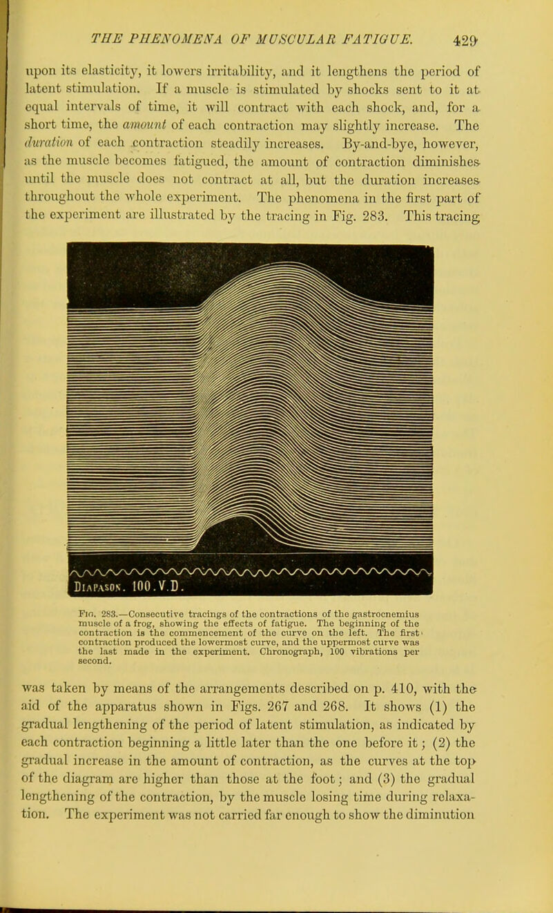 THE PHENOMENA OF MUSCULAR FATIGUE. 4291 upon its elasticity, it lowers irritability, and it lengthens the period of latent stimulation. If a muscle is stimulated by shocks sent to it at equal intervals of time, it will contract with each shock, and, for a short time, the amount of each contraction may slightly increase. The duration of each .contraction steadily increases. By-and-bye, however, as the muscle becomes fatigued, the amount of contraction diminishes- until the muscle does not contract at all, but the duration increases throughout the whole experiment. The phenomena in the first part of the experiment are illustrated by the tracing in Fig. 283. This tracing Fio. 2S3.—Consecutive tracings of the contractions of the gastrocnemius muscle of a frog, showing the effects of fatigue. The beginning of the contraction is the commencement of the curve on the left. The first- contraction produced the lowermost curve, and the uppermost curve was the last made in the experiment. Chronograph, 100 vibrations per second. was taken by means of the arrangements described on p. 410, with the aid of the apparatus shown in Figs. 267 and 268. It shows (1) the gradual lengthening of the period of latent stimulation, as indicated by each contraction beginning a little later than the one before it; (2) the gradual increase in the amount of contraction, as the curves at the top of the diagram are higher than those at the foot; and (3) the gradual lengthening of the contraction, by the muscle losing time during relaxa- tion. The experiment was not carried far enough to show the diminution