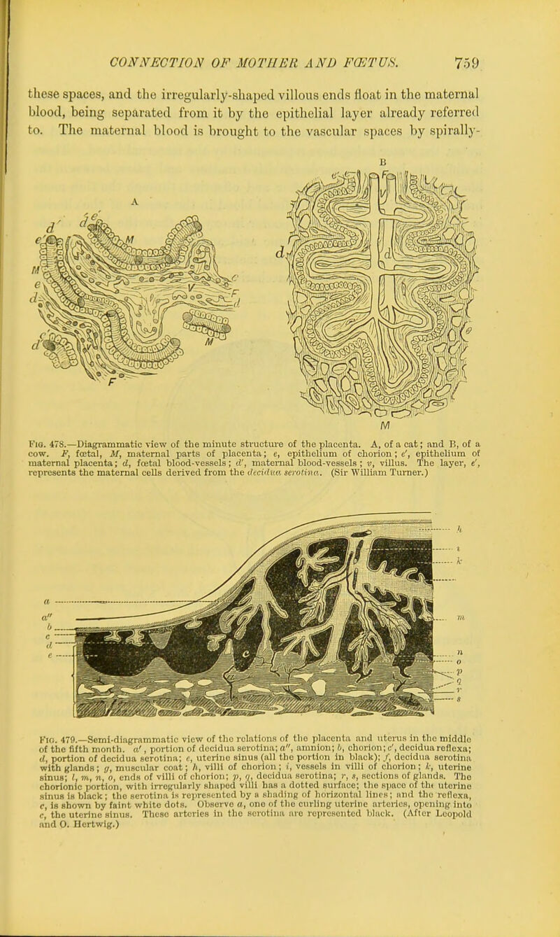 these spaces, and the irregularly-shaped villous ends float in the maternal blood, being separated from it by the epithelial layer already referred to. The maternal blood is brought to the vascular spaces by spirally- n Fig. 478.—Diagrammatic view of the minute structure of the placenta. A, of a cat; and B, of a cow. F, foetal, M, maternal parts of placenta; e, epithelium of chorion; e', epithelium of maternal placenta; d, foetal blood-vessels; d', maternal blood-vessels ; v, villus. The layer, e', represents the maternal cells derived from the decidua, serotina. (Sir William Turner.) Fig. 479.—Semi-diagrammatic view of the relations of the placenta and uterus in the middle of the fifth month, a1, portion of decidua serotina; a, amnion; b, chorion; c', decidua roflexa; d, portion of decidua serotina; e, uterine sinus fall the portion in black); /, decidua serotina with glands; g, muscular coat; h, villi of chorion; i, vessels in villi of chorion; k, uterine sinus; l, m, n, o, ends of villi of chorion; p, q, decidua serotina; r, s, sections of glands. Tho chorionic portion, with irrogulnrly shaped villi has a dotted surface; the spaco of tin uterine sinus is black; the serotina is represented by a shading of horizontal lines; and the reflexa, c, is shown by faint white dots. Observe a, one of the curling uterine arteries, opening into c, the uterine sinus. These arteries in the serotina are represented black. (After Leopold and 0. Hertwig.)