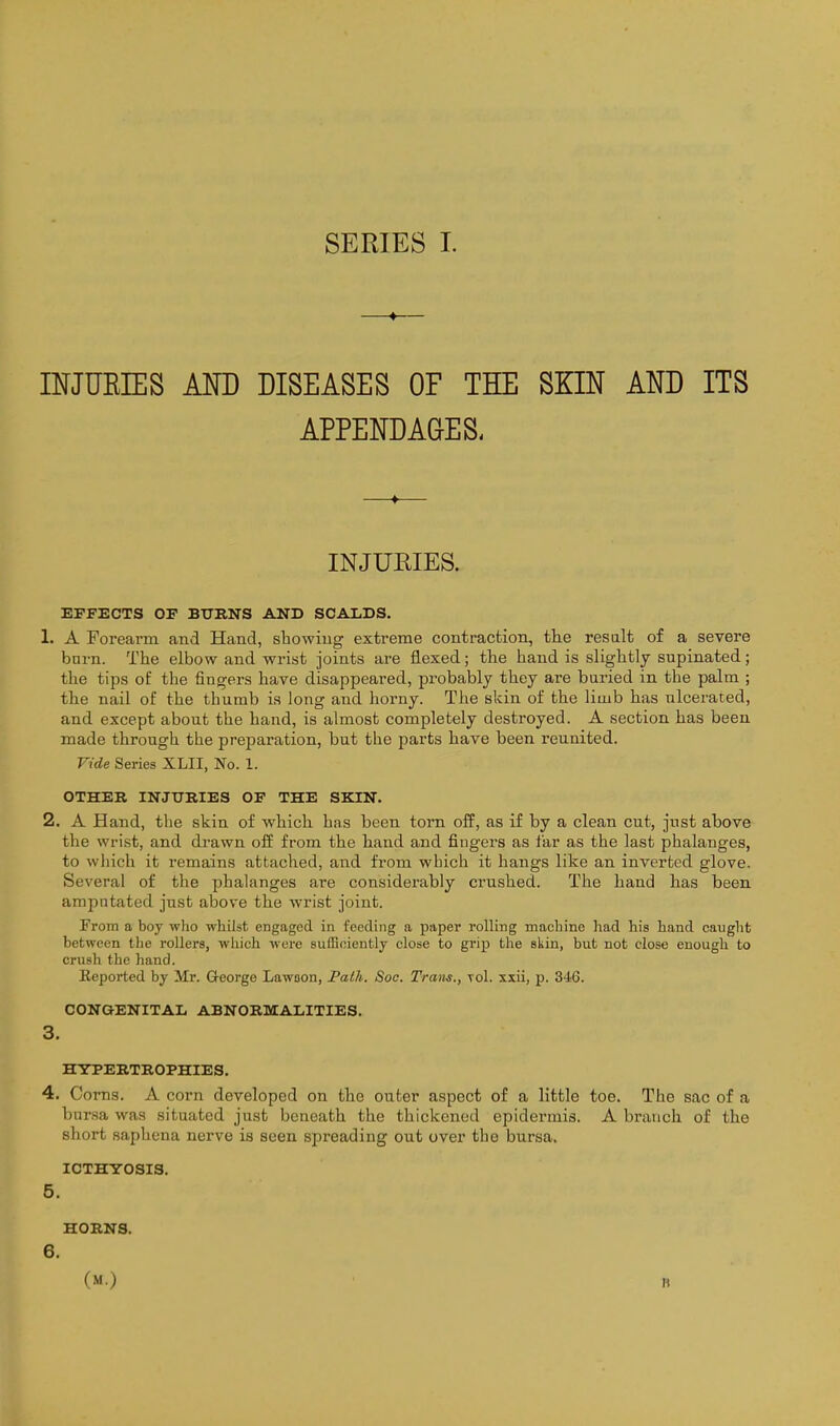 —♦— INJUEIES MD DISEASES OF THE SKIN AND ITS APPENDAGES. —♦— INJURIES. EFFECTS OF BURNS AND SCALDS. 1. A Forearm and Hand, stowing extreme contraction, the result of a severe barn. The elbow and wrist joints are flexed; the hand is slightly supinated; the tips of the fingers have disappeared, pi-obably they are buried in the palm ; the nail of the thumb is long and horny. The skin of the limb has ulcerated, and except about the hand, is almost completely destroyed. A section has been made through the preparation, but the parts have been reunited. Vide Series XLII, No. 1. OTHER INJURIES OF THE SKIN. 2. A Hand, the skin of which has been torn off, as if by a clean cut, just above the wrist, and drawn off from the hand and fingers as far as the last phalanges, to which it remains attached, and from which it hangs like an inverted glove. Several of the phalanges are considerably crushed. The hand has been amputated just above the wrist joint. From a boy wlio whilst engaged in feeding a paper rolling macLine laad his hand canglit between the rollers, which were sufficiently close to grip the skin, but not close enough to crxish the hand. Reported by Mr. Q-eorge Lawoon, Palh. Soc. Trans., toI. sxii, p. 346. CONGENITAIi ABNORMAIilTIES. 3. HYPERTROPHIES. 4. Corns. A corn developed on the outer aspect of a little toe. The sac of a bursa was situated just beneath the thickened epidermis. A branch of the short saphena nerve is seen spreading out over the bursa. ICTHYOSIS. 5. HORNS. 6, (M.) It