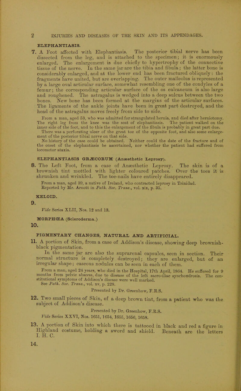 ELEPHANTIASIS. 7. A Foot affected with Elephantiasis. The posterior tibial nerve has been dissected from the leg, and is attached to the specimen; it is enormously- enlarged. The enlargement is due chiefly to hypertrophy of the connective tissue of the nerve. In the same jar are the tibia and fibula; the latter bone is considerably enlarged, and at the lower end has been fractured obliquely: the fragments have united, but are overlapping. The outer malleolus is represented by a large oval articular surface, somewhat resembling one of the condyles of a femur; the corresponding articular surface of the os calcaneum is also large and roughened. The astragalus is wedged into a deep sulcus between the two hones. New bone has been formed at the margins of the articular surfaces. The ligaments of the ankle joints have been in great part destroyed, and the head of the astragalus moves freely from side to side. From a man, aged 53, who waa admitted for strangulated hernia, and died after herniotomy. The right leg from the knee was the seat of elejjhantiasis. The patient walked on the inner side of the foot, and to this the enlargement of the fibula is probably in great part due. There was a perforating ulcer of the great toe of the opposite foot, and also some enlarge- ment of the posterior tibial nerve on that side. No history of the case could be obtained. Neither could the date of the fracture and of the onset of the elephantiasis be ascertained, nor whether the patient had suffered from locomotor ataxia. ELEPHANTIASIS GRiECORTJM: (Ansesthetic Leprosy). 8. The Left Foot, from a case of Anaesthetic Leprosy. The skin is of a brownish tint mottled with lighter coloured patches. Over the toes it is shrunken and wrinkled. The toe-nails have entirely disappeared. From a man, aged 39, a native of Ireland, who contracted leprosy in Trinidad. Eeported by Mr. Arnott in Fath. Soc. Trans., vol. xix, p. 35. KELOID. 9. Vide Series XLII, Nos. 12 and 13. MORPHCEA (Scleroderma.) 10. PIGMENTARY CHANGES, NATITRAL AND ARTIFICIAL. 11. A portion of Skin, from a case of Addison's disease, showing deep brownish- black pigmentation. In the same jar are also the suprarenal capsules, seen in section. Their normal structure is completely destroyed; they are enlarged, but of an irregular shape; caseous nodules can be seen in each of them. From a man, aged 24 years, who died in the Hospital, I7th April, 1864. He suffered for 9 months from pelvic abscess, due to disease of the left sacro-iliac synchondrosis. The con- stitutional symptoms of Addison's disease were well marked. See Path. Soc. Trans., vol. xv, p. 228. Presented by Dr. Glreenhow, F.E.S. 12. Two small pieces of Skin, of a deep brown tint, from a patient who was the subject of Addison's disease. Presented by Dr. Greenhow, F.E.S. Vide Series XXVI, Nos. 1651, 1654, 1655, 1656, 1658. 13. A portion of Skin into which there is tattooed in black and red a figure in Highland costume, holding a sword and shield. Beneath are the letters 14.