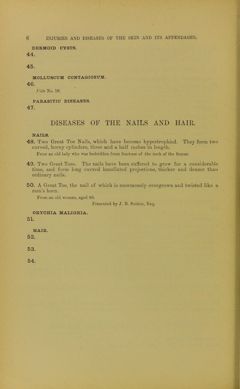 DERMOID CYSTS. 44. 45. MOLLTJSCtTM CONTAGIOSTJU. 46. Vide No. 16. PARASITIC DISEASES. 47. DISEASES OF THE NAILS AND HAIR. NAILS. 48. Two Great Toe Nails, whicli have become hypertropliied. Tliey form two curved, horny cylinders, three and a lialf inches in length. From an old lady who was bedridden from fracture of the neck of the femur. 49. Two Great Toes. The nails have been suffered to grow for a considerable time, and form long curved lamellated projections, thicker and denser than ordinary nails. 50. A Great Toe, the nail of which is enormously overgrown and twisted like a ram's horn. From an old woman, aged 83. Presented by J. B. Sutton, Esq. ORYCHIA MALIGNIA. 51. HAIR. 52. 53. 54.