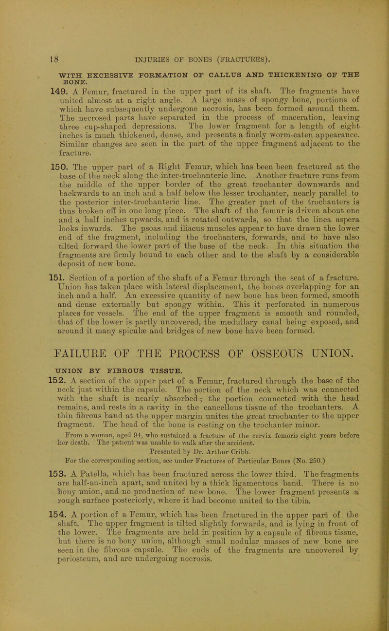 WITH EXCESSIVE FOBMATION OF CALLtTS AND THICKENING OF THE BONE. 149. A Femur, fractured in the upper part of its sliaft. The fragments have united almost at a i-ight angle. A large mass of spongy bone, portions of which hare subsequently undergone necrosis, has been formed around them. The necrosed parts have separated in the process of maceration, leaving three cup-shaped depressions. The lower fragment for a length of eight inches is much thickened, dense, and ^iresents a finely worm-eaten appearance. Similar changes are seen in the part of the upper fragment adjacent to the fracture. 150. The upper part of a Right Femur, which has been been fractured at the base of the neck along the inter-trochanteric line. Another fracture runs from the middle of the upper border of the great trochanter downwards and backwards to an inch and a half below the lesser trochanter, nearly parallel to the posterior inter-trochanteric line. The greater part of the trochanters is thus broken oif in one long piece. The shaft of the femur is driven about one and a half inches upwards, and is rotated outwards, so that the linea aspera looks inwards. The psoas and iliacus muscles appear to have drawn the lower end of the fragment, including the trochanters, forwards, and to have also tilted forward the lower part of the base of the neck. In this situation the fragments are firmly bound to each other and to the shaft by a considerable deposit of new bone. 151. Section of a portion of the shaft of a Femur through the seat of a fracture. Union has taken place with lateral displacement, the bones overlapping for an inch and a half. An excessive quantity of new bone has been formed, smooth and dense externally but spongy within. This it perfoi'ated in numerous places for vessels. The end of the upper fragment is smooth and rounded, that of the lower is partly uncovered, the medullary canal being exposed, and around it many spiculse and bridges of new bone have been formed. FAILUKE OF THE PEOCESS OF OSSEOUS UNION. UNION BY FIBROtrS TISSUE. 152. A section of the upper part of a Femur, fractured through the base of the neck just within the capsule. The portion of the neck which was connected with the shaft is nearly absorbed; the portion connected with the head remains, and rests in a cavity in the cancellous tissue of the trochanters. A thin fibrous band at the upper margin unites the great trochanter to the upper fragment. The head of the bone is resting on the trochanter minor. From a woman, aged 94, -svlio sustained a fracture of tlie cervix femoris eight years before her death. The patient was unable to walk after the accident. Presented by Dr. Arthur Cribb. For the corresponding section, see under Fractures of Particular Bones (No. 250.) 153. A Patella, which has been fractured across the lower third. The fragments are half-an-inch apart, and united by a thick ligamentous band. There is no bony union, and no production of new bone. The lower fragment presents a rough surface posteriorly, where it had become united to the tibia. 154. A portion of a Femur, which has been fractured in the upper part of the shaft. The upper fragment is tilted slightly forwards, and is lying in front of the lower. The fragments are held in position by a capsule of fibrous tissue, but there is no bony union, although small nodular masses of new bone are seen in the fibrous capsule. The ends of the fragments are uncovered by periosteum, and are undergoing necrosis.