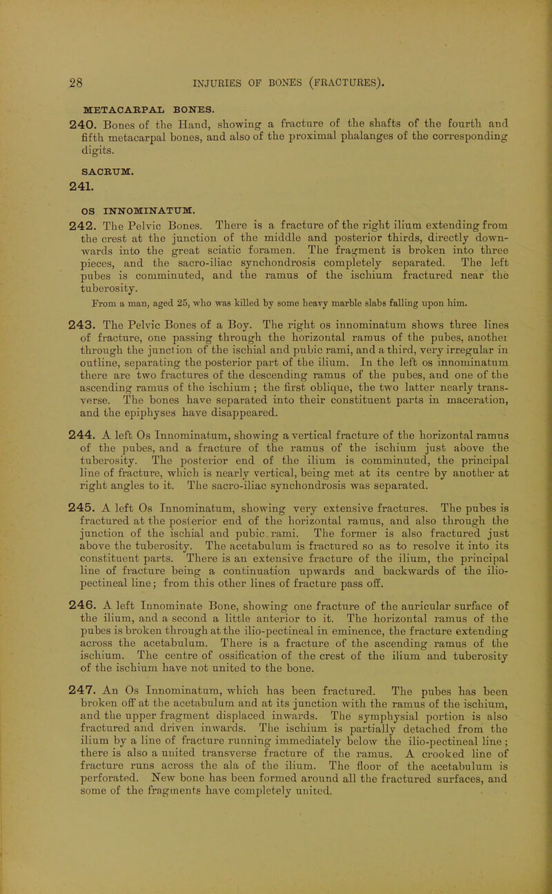 METACARPAL BONES. 240. Bones of the Hand, showing a fracture of the shafts of the fourth and fifth metacarpal bones, and also of the proximal phalanges of the corresponding digits. SACRITM. 241. OS mNOMINATXTM. 242. The Pelvic Bones. There is a fracture of the right ilium extending from the crest at the junction, of the middle and posterior thirds, directly down- wards into the great sciatic foramen. The fragment is broken into three pieces, and the sacro-iliac synchondrosis completely separated. The left pubes is comminuted, and the ramus of the ischium fractured near the tuberosity. From a man, aged 25, who was killed by some heayy marble slabs falling upon him. 243. The Pelvic Bones of a Boy. The right os innominatum shows three lines of fracture, one passing through the horizontal ramus of the pubes, anothei through the junction of the ischial and pubic rami, and a third, very irregular in outline, separating the posterior part of the ilium. In the left os innominatum there are two fractures of the descending ramus of the pubes, and one of the ascending ramus of the ischium ; the first oblique, the two latter nearly trans- verse. The bones have separated into their constituent parts in maceration, and the epiphyses have disappeared. 244. A left Os Innominatum, stowing a vertical fracture of the horizontal ramus of the pubes, and a fracture of the ramus of the ischium just above the tuberosity. The posterior end of the ilium is comminuted, the principal line of fractui'e, which is nearly vertical, being met at its centre by another at right angles to it. The sacro-iliac synchondrosis was separated. 245. A left Os Innominatum, showing very extensive fractures. The pubes is fractured at the posterior end of the horizontal ramus, and also through the junction of the ischial and pubic, rami. The former is also fractured just above the tuberosity. The acetabulum is fractured so as to resolve it into its constituent parts. There is an extensive fracture of the ilium, the principal line of fracture being a continuation upwards and backwards of the ilio- pectineal line; from this other lines of fracture pass off. 246. A left Innominate Bone, showing one fracture of the auricular surface of the ilium, and a second a little anterior to it. The horizontal ramus of the pubes is broken through at the ilio-pectineal in eminence, the fracture extending across the acetabulum. There is a fracture of the ascending ramus of the ischium. The centre of ossification of the crest of the ilium and tuberosity of the ischium have not united to the bone. 247. An Os Innominatum, which has been fractured. The pubes has been broken ofi at the acetabulum and at its junction with the ramus of the ischium, and the upper fragment displaced inwards. The symphysial portion is also fractured and driven inwards. Tlie ischium is partially detached from the ilium by a line of fracture running immediately below the ilio-pectineal line ; there is also a united transverse fracture of the ramus. A crooked line of fracture runs across the ala of the ilium. The floor of the acetabulum is perforated. New bone has been formed around all the fractured surfaces, and some of the fragments have completely united. i