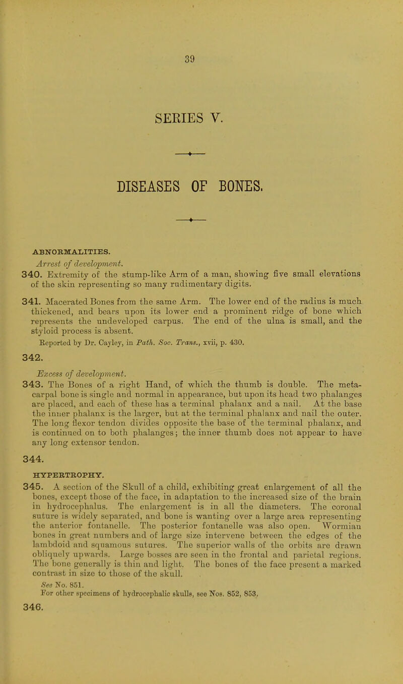 SERIES V. DISEASES OF BONES. —♦— ABNORMALITIES. Arrest of development. 340. Exti-emity of the stump-like Arm of a man, showing five small elevations of the skin representing so many radimentary digits. 341. Macerated Bones from the same Arm. The lower end of the radius is much thickened, and bears upon its lower end a prominent ridge of bone which, represents the undeveloped carpus. The end of the ulna is small, and the styloid process is absent. Eeported by Dr. Cayley, in PatJi,. Soc. Trans., xvii, p. 430. 342. Excess of development. 343. The Bones of a right Hand, of which the thumb is double. The meta- carpal bone is single and normal in appearance, but upon its head two phalanges are placed, and each of these has a terminal phalanx and a nail. At the base the inner phalanx is the lai'ger, but at the terminal phalanx and nail the outer. The long flexor tendon divides opposite the base of the terminal phalanx, and is continued on to both phalanges; the inner thumb does not appear to have any long extensor tendon. 344. HYPERTROPHY. 345. A section of the Skull of a child, exhibiting great enlargement of all the bones, except those of the face, in adaptation to the increased size of the brain in hydrocephalus. The enlargement is in all the diameters. The coronal suture is widely separaterl, and bone is wanting over a large area representing the anterior fontanelle. The posterior fontanelle was also opcu. Wormian bones in great numbers and of largo size intervene between the edges of the lambdoid and squamous sutures. The superior walls of the orbits are drawn obliquely upwards. Large bosses are seen in the frontal and parietal regions. The bone generally is thin and light. The bones of the face jircsent a marked contrast in size to those of the skull. See No. 851. For other specimens of hydrocephalic skulls, see Nos. 852, 853, 346.