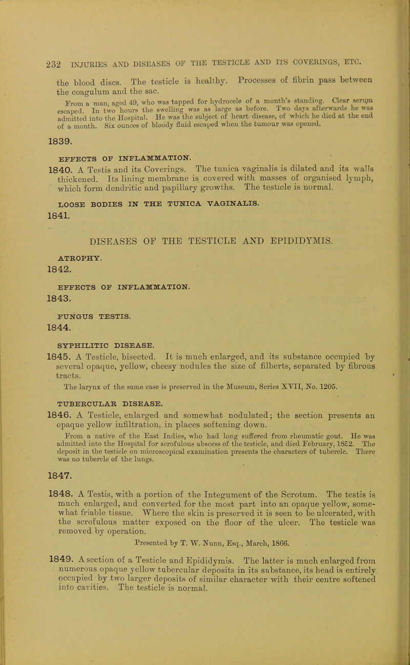 the blood discs. The testicle is healthy. Processes of fibrin pass between the coagulum and the sac. From a man, aged 49, who was tapped for hydrocele of a month's standing. Clear Beriyn escaped. In two°hom-s the sweUing was as large as before. Two days afterwards he was admitted into tlie Hospital. He was the subject of heart disease, of which he died at the end of a month. Six ounces of bloody fluid escaped wlien the tumour was opened. 1839. EFFECTS OF mFLAMMATION. 1840. A Testis and its Coverings. The tunica vaginalis is dilated and its walls thickened. Its lining membrane is covered with masses of organised lymph, which form dendritic and papillary growths. The testicle is normal. LOOSE BODIES IN THE TUNICA VAGINALIS. 1841. DISEASES OF THE TESTICLE AND EPIDIDYMIS. ATROPHY. 1842. EFFECTS OF INFLAMMATION. 1843. FUNGUS TESTIS. 1844. SYPHILITIC DISEASE. 1845. A Testicle, bisected. It is much enlarged, and its substance occupied by several opaque, yellow, cheesy nodules the size of filberts, separated by fibrous tracts. The larynx of the same case is preserved in the Museum, Series XYII, No. 1205. TUBERCULAR DISEASE. 1846. A Testicle, enlarged and somewhat nodulated; the section presents an opaque yellow infiltration, in places softening down. From a native of the East Indies, who had long suffered from rhevmaatic gout. He was admitted into the Hospital for scrofulous abscess of the testicle, and died February, 1852. The deposit in the testicle on microscopical examination presents the cliaracters of tubercle. There was no tubercle of the lungs. 1847. 1848. A Testis, with a portion of the Integument of the Scrotum. The testis is. much enlarged, and converted for the most part into an opaque yellow, some- what friable tissue. Where the skin is preserved it is seen to be ulcerated, with the scrofulous matter exposed on the floor of the ulcer. The testicle was removed by operation. Presented by T. W. Nunn, Esq., March, 1866. 1849. A section of a Testicle and Epididymis. The latter is much enlarged from numerous opaque yellow tubercular deposits in its substance, its head is entirely occupied by two larger deposits of similar character with their centre softened into cavities. The testicle is normal.