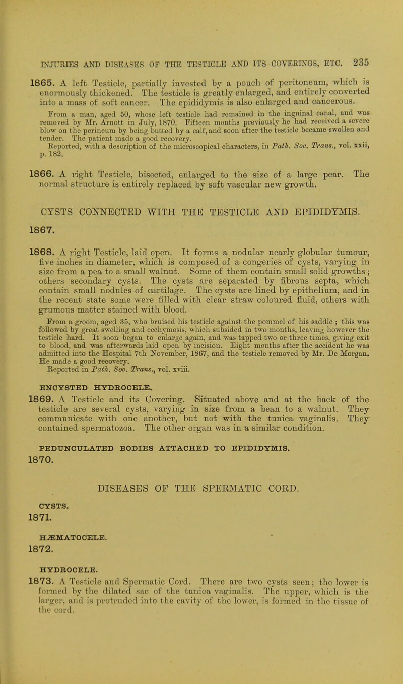 1865. A left Testicle, partially invested by a pouch of peritoneum, which is enormously thickened. The testicle is greatly enlarged, and entirely converted into a mass of soft cancer. The epididymis is also enlarged and cancerous. From a man, aged 50, whose left testicle had remained in the inguinal canal, and was removed by Mr. Arnott in July, 1870. Fifteen months previously he had received a severe blow on tlie perineum by being butted by a calf, and soon after the testicle became swollen and tender. The patient made a good recovery. Keported, with a description of the microscopical characters, in Path. Soo. Trans., vol. xxii, p. 182. 1866. A I'ight Testicle, bisected, enlai-ged to the size of a large pear. The normal structui-e is entirely i-eplaced by soft vascular new growth. CYSTS CONNECTED WITH THE TESTICLE AND EPIDIDYMIS. 1867. 1868. A right Testicle, laid open. It forms a nodular nearly globular tumour, five inches in diameter, which is composed of a congeries of cysts, varying in size from a pea to a small walnut. Some of them contain small solid growths; others secondary cysts. The cysts are separated by fibrous septa, which contain small nodules of cartilage. The cysts are lined by epithelium, and in the recent state some were filled with clear straw coloured fluid, others with grumous matter stained with blood. From a gi-oom, aged 35, who bruised his testicle against the pommel of his saddle ; this was followed by great swelling and ecchymosis, which subsided in two months, leaving however the testicle hard. It soon began to enlarge again, and was tapped two or three times, giving exit to blood, and was afterwards laid open by incision. Eight months after the accident he was admitted into the Hospital 7th November, 1867, and the testicle removed by Mr. De Morgan. He made a good recovery. Keported in Path, Soc. Trans., vol. xviii. ENCYSTED HYDROCELE. 1869. A Testicle and its Covering. Situated above and at the back of the testicle are several cysts, varying in size from a bean to a walnut. They communicate with one another, but not with the tunica vaginalis. They contained spermatozoa. The other organ was in a similar condition. PEDUNCULATED BODIES ATTACHED TO EPIDIDYMIS. 1870. DISEASES OP THE SPEEMATIC COED. CYSTS. 1871. HEMATOCELE. 1872. HYDROCELE. 1873. A Testicle and Spermatic Cord. There are two cysts seen; the lower is foi-med by the dilated sac of the tunica vaginalis. The upper, which is the larger, and is protruded into the cavity of the lower, is formed in the tissue of the cord.