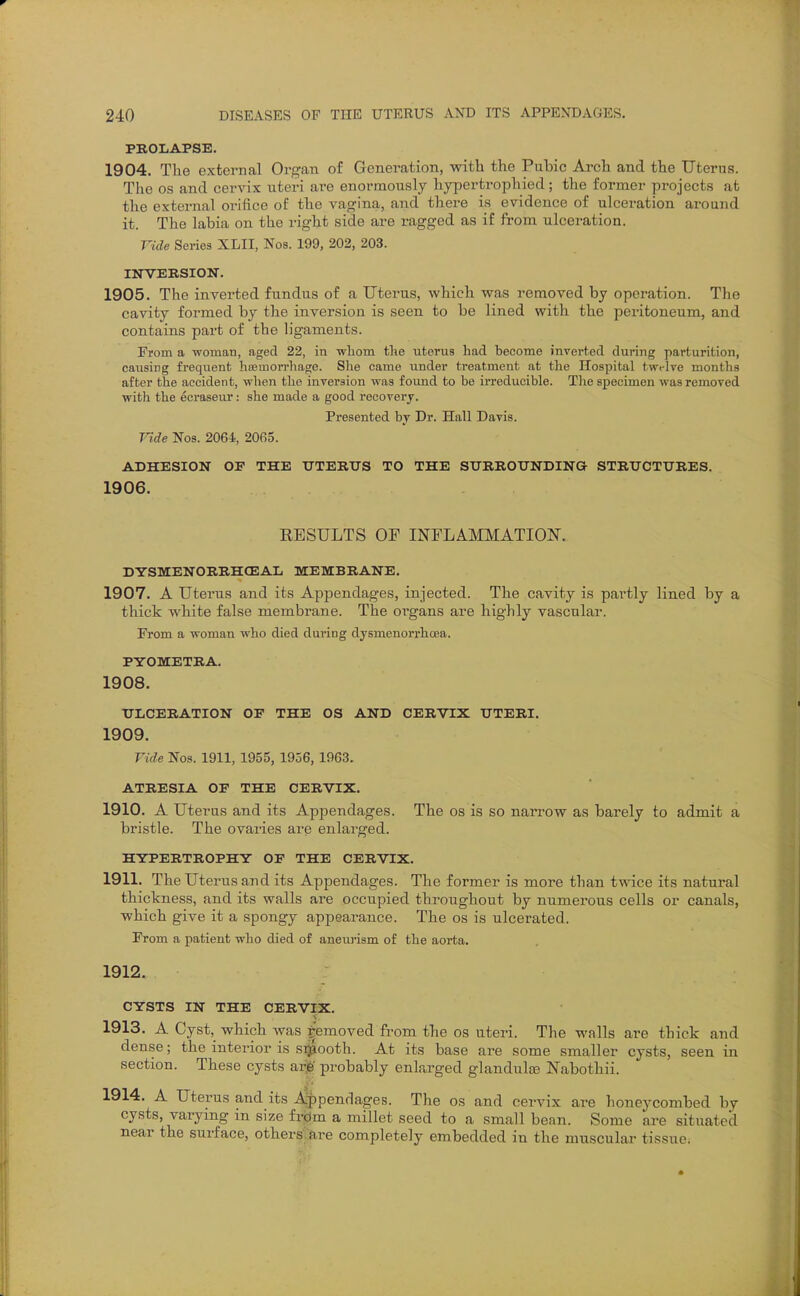 PROLAPSE. 1904. The external Organ of Generation, with the Pubic Arch and the Uterus. Tlie OS and cervix uteri are enormously hypertrophied; the former projects at the external oi-ifice of the vagina, and there is evidence of ulceration around it. The labia on the right side are ragged as if from ulceration. Vide Series XLII, Nos. 199, 202, 203. INVERSIOIT. 1905. The inverted fundus of a Uterus, which was removed by operation. The cavity formed by the inversion is seen to be lined with the peritoneum, and contains part of the ligaments. From a woman, aged 22, in whom the uterus had become inverted during parturition, causing frequent hoemon-hage. She came under treatment at the Hospital twt-lve months after the accident, when the inversion was foimd to be irreducible. Tlie specimen was removed with the ecraseux: she made a good recovery. Presented by Dr. Hall Davis. Vide Nos. 2064, 2065. ADHESION OF THE UTERUS TO THE SURROUNDING STRUCTURES. 1906. EESULTS OF INFLAMMATION. DYSMENORRHCEAIi MEMBRANE. 1907. A Uterus and its Appendages, injected. The cavity is partly lined by a thick white false membrane. The organs are highly vascular. From a woman who died during dysmenorrhoea. PYOMETRA. 1908. ULCERATION OF THE OS AND CERVIX UTERI. 1909. Vide Nos. 1911, 1955, 1956, 1963. ATRESIA OF THE CERVIX. 1910. A Uterus and its Apjjendages. The os is so narrow as barely to admit a bristle. The ovaries are enlarged. HYPERTROPHY OF THE CERVIX. 1911. The Uterus and its Appendages. The former is more than t^ace its natural thickness, and its walls are occupied throughout by numerous cells or canals, which give it a spongy appearance. The os is ulcerated. From a patient who died of aneu)'ism of the aorta. 1912. CYSTS IN THE CERVIX. 1913. A Cyst, which was Removed from the os uteri. The walls are thick and dense; the interior is si^^ooth. At its base are some smaller cysts, seen in section. These cysts arj6; probably enlarged glandulas Nabothii. 1914. A Uterus and its Xppendages. The os and cervix are honeycombed by cysts, varymg m size frdm a millet seed to a small bean. Some are situated near the surface, others are completely embedded in the muscular tissue.
