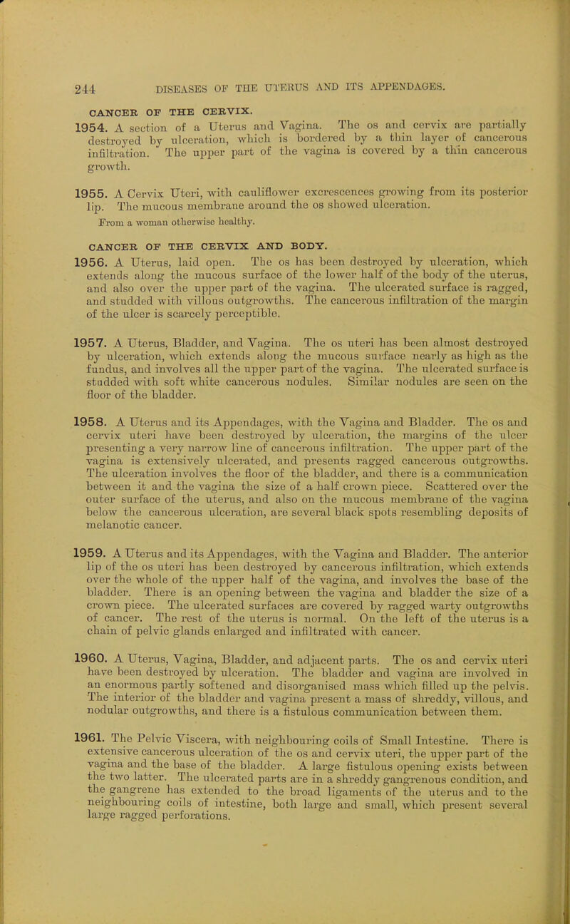 CANCER or THE CERVIX. 1954. A section of a Uterus and Vagina. The os and cervix are partially- destroyed hy nloeration, wliicli is bordered by a thin layer of cancerous infiltration. The upper part of the vagina is covered by a thin cancei'ous growth. 1955. A Cervix Uteri, with cauliflower excrescences growing from its posterior lip. The mucous membrane aroand the os showed ulceration. From a ■woman otherwise healthy. CANCER CI THE CERVIX AND BODY. 1956. A Uterus, laid open. The os has been destroyed by ulceration, which extends along the mucous surface of the lower half of the body of the uterus, and also over the upper part of the vagina. The ulcerated surface is ragged, and studded with villous outgrowths. The cancerous infiltration of the margin of the ulcer is scarcely perceptible. 1957. A Uterus, Bladder, and Vagina. The os uteri has been almost destroyed by ulceration, which extends along the mucous surface nearly as high as the fundus, and involves all the upper part of the vagina. The ulcerated surface is studded with soft white cancerous nodules. Similar nodules are seen on the floor of the bladder. 1958. A Uterus and its Apjjendages, with the Vagina and Bladder. The os and cervix uteri have been destroyed by ulceration, the margins of the ulcer presenting a very narrow line of cancei-ous infiltration. The upper part of the vagina is extensively ulcerated, and presents ragged cancerous outgrowths. The ulceration involves the floor of the bladder, and there is a communication between it and the vagina the size of a half crown piece. Scattered over the outer surface of the uterus, and also on the mucous membrane of the vagina below the cancerous ulceration, are several black spots resembling deposits of melanotic cancer. 1959. A Uterus audits Appendages, with the Vagina and Bladder. The anterior lip of the OS uteri has been destroyed by cancerous infiltx'ation, which extends over the whole of the upper half of the vagina, and involves the base of the bladder. There is an opening between the vagina and bladder the size of a crown piece. The ulcerated surfaces are covered by ragged warty outgrowths of cancer. The rest of the uterus is noiTaal. On the left of the uterus is a chain of pelvic glands enlarged and infiltrated with cancer. 1960. A Uterus, Vagina, Bladder, and adjacent parts. The os and cervix uteri have been destroyed by ulceration. The bladder and vagina are involved in an enormous partly softened and disorganised mass which filled up the pelvis. The interior of the bladder and vagina present a mass of shreddy, villous, and nodular outgrowths, and there is a fistulous communication between them. 1961. The Pelvic Viscera, with neighbouring coils of Small Intestine. There is extensive cancerous ulceration of the os and ceiwix uteri, the upper pai't of the vagina and the base of the bladder. A large fistulous opening exists between the two latter. The ulcerated parts are in a shreddy gangrenous condition, and the gangrene has extended to the broad ligaments of the uterus and to the neighbouring coils of intestine, both large and small, which present several large ragged perforations.