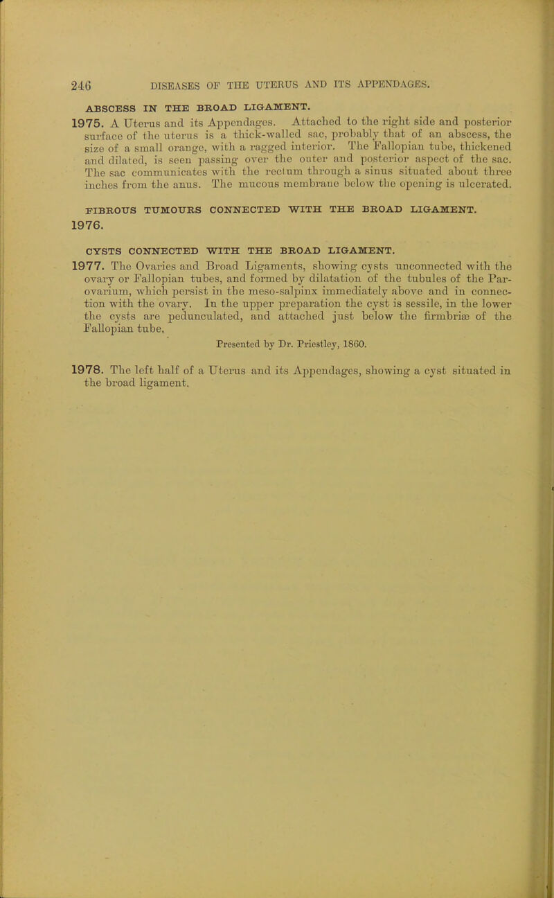 ABSCESS IN THE BROAD LIGAMENT. 1975. A Uterus and its Appendages. Attached to tlie right side and posterior sui't'ace of the uterus is a thick-walled sac, probably that of an abscess, the size of a small orauge, with a ragged interior. The Fallopian tube, thickened and dilated, is seen jmssing over the outer and posterior aspect of the sac. The sac communicates with the reclum through a sinus situated about three inches from the anus. The mucous membrane below the opening is ulcerated. FIBROUS TXTMOURS CONNECTED WITH THE BROAD LIGAMENT. 1976. CYSTS CONNECTED WITH THE BROAD LIGAMENT. 1977. The Ovaries and Broad Ligaments, showing cysts unconnected with the ovary or Fallopian tubes, and formed by dilatation of the tubules of the Par- ovarium, w^hich persist in the meso-salpinx immediately above and in connec- tion with the ovary. In the upper preparation the cyst is sessile, in the lower the cysts are pedunculated, and attached just below the firmbriee of the Fallopian tube. Presented by Dr. Priestley, 1860. 1978. The left half of a Uterus and its Appendages, showing a cyst situated in the broad ligament.