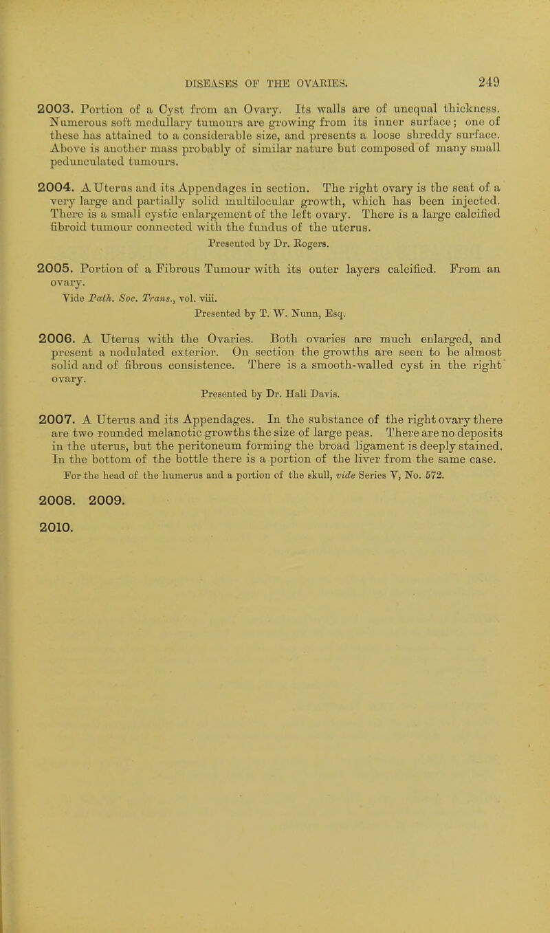 2003. Portion of a Cyst from an Ovary. Its walls are of uneqnal tliickness. Numerous soft mnduUary tumours are growing from its inner surface; one of tliese has attained to a considerable size, and presents a loose shreddy surface. Above is another mass probably of similar nature but composed of many small pedunculated tumours. 2004. A Uterus and its Appendages in section. The right ovary is the seat of a very large and partially solid multilocular growth, which has been injected. Thei-e is a small cystic enlargement of the left ovary. There is a large calcified fibroid tumour connected with the fundus of the uterus. Presented by Dr. Eogera. 2005. Portion of a Fibrous Tumour with its outer layers calcified. From an ovary. Vide Path. Soc. Trans., vol. viii. Presented by T. W. Nunn, Esq. 2006. A Uterus with the Ovaries. Both ovaries are much enlarged, and present a nodulated exterior. On section the growths are seen to be almost solid and of fibrous consistence. There is a smooth-walled cyst in the right ovary. Presented by Dr. Hall Davis. 2007. A uterus and its Appendages. In the substance of the right ovary there are two rounded melanotic growths the size of large peas. There are no deposits in the uterus, but the peritoneum forming the broad ligament is deeply stained. In the bottom of the bottle there is a portion of the liver from the same case. For the head of the hvunerus and a portion of the skull, vide Series V, No. 572. 2008. 2009. 2010.