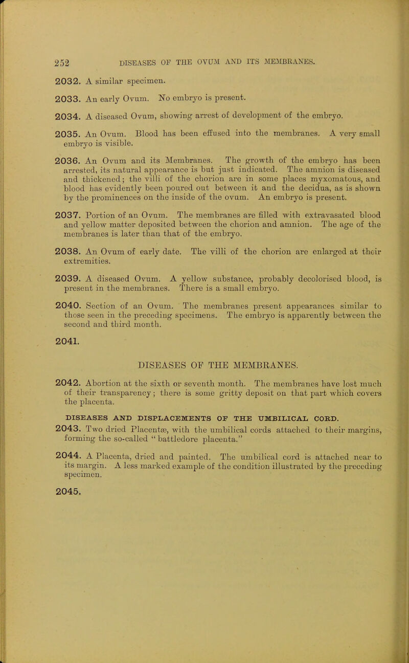 2032. A similar specimen. 2033. An early Ovum. No embryo is present. 2034. A diseased Ovum, showing arrest of development of the embryo. 2035. An Ovum. Blood lias been effused into the membranes. A very small embryo is visible. 2036. An Ovum and its Membranes. The growth of the embryo has been arrested, its natural appearance is but just indicated. The amnion is diseased and thickened; the villi of the chorion are in some places myxomatous, and blood has evidently been poured out between it and the deoidua, as is shown by the prominences on the inside of the ovum. An embryo is present. 2037. Portion of an Ovum. The membranes are filled with extravasated blood and yellow matter deposited between the chorion and amnion. The age of the membranes is later than that of the embryo. 2038. An Ovum of early date. The villi of the chorion are enlarged at their extremities. 2039. A diseased Ovum. A yellow substance, probably decolorised blood, is present in th.e membranes. There is a small embryo. 2040. Section of an Ovum. The membranes present appearances similar to those seen in the preceding specimens. The embryo is apparently between the second and third month. 2041. DISEASES OF THE MEMBRANES. 2042. Abortion at the sixth or seventh month. The membranes have lost much of their transparency; there is some gritty deposit on that part which covers the placenta. DISEASES AND DISPLACEMENTS OF THE UMBILICAL COBD. 2043. Two dried Placentge, with the umbilical cords attached to their margins, forming the so-called battledore placenta. 2044. A Placenta, dried and painted. The umbilical cord is attached near to its margin. A less marked example of the condition illustrated by the preceding specimen. 2045.