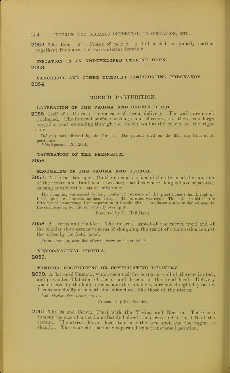 2052. The Bones of a Foetus of nearly the full period ivregalarly matted together; from a case of extra-uterine foetation. FCETATION IN AN UNDEVELOPED UTEEINE HORN. 2053. CANCEROUS AND OTHER TUMOURS COMPLICATING PREGNANCY. 2054. MOEBID PARTURITION. LACERATION OF THE VAGINA AND CERVIX UTERI. 2055. Half of a Uterus ; from a case of recent deliveiy. The walls are much thickened. The internal surface is rough and shreddy, and there is a large irregular rent extending through the uterine wall at the cervix on the right side. Delivery was effected by the forceps. The patient died on the fifth day from acute peritonitis. Vide Specimen No. 2061. LACERATION OF THE PERINiEUM. 2056. SLOUGHING OF THE VAGINA AND UTERUS. 2057. A Uterus, laid open. On the mucous surface of the uterus at the junction of the cervix and fundus are two large patches where sloughs have separated, causing considerable loss of substance. The sloughing was caused by long continued pressure of the practitioner's hand, kept up for the purpose of restraining haemorrhage. The os uteri was rigid. The patient died on the fifth day of hemorrhage from separation of the sloughs. The placenta was implanted near to the OS internum, but did not actually overlap it. Presented by Dr. HaU Davis. 2058. A uterus and Bladder. The internal aspect of the cervix uteri and of the bladder show extensive areas of sloughing, the result of compression against the pubes by the foetal head. From a woman, who died after delivery by the crotchet. VESICO-VAGINAL FISTULA. 2059. TUMOURS OBSTRUCTING OR COMPLICATING DELIVERY. 2060. A flattened Tumour, which occupied the posterior wall of the cervix uteri, and prevented dilatation of the os and descent of the foetal head. Delivery was effected by the long forceps, and the tumour was removed eight days after. It consists chiefly of smooth muscular fibres like those of the uterus. Vide Ohstet. Soc. Trans., vol. i. Presented by Dr. Priestley. 2061. The Os and Cervix Uteri, witli the Vngina and Rectum. Thei-e is a tumour the size of a fist immediately behind the cervix and to the left of the recttim. The uterus shoAvs a laceration near the same spot, and the A^agina is sloughy. The os uteri is partially separated by a transverse lacei-ation.