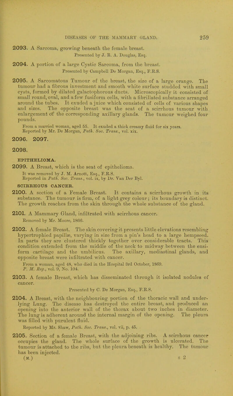 2093. A Sarcoma, growing beneath, tlie female breast. Presented bj J. E. A. Douglas, Esq. 2094. A portion of a large Cystic Sarcoma, from the breast. Presented by Campbell Do Morgan, Esq., F.E.S. 2095. A Sarcomatous Tumour of the breast, the size of a large orange. The tnmour had a fibrous investment and smooth white surface studded with small cysts, formed by dilated galactophorous ducts. Microscopically it consisted of small round, oval, and a few fusiform colls, with a fibrillated substance arranged around the tubes. It exuded a juice which consisted of cells of various shapes and sizes. The opposite breast was the seat of a scirrhous tumour with enlaa-gement of the corresponding axillary glands. The tumour weighed four pounds. From a married woman, aged 55. It exuded a thick creamy fluid for six years. Reported by Mr. De Morgan, Fath. Soc. Trans., vol. xix. 2096. 2097. 2098. EPITHELIOMA. 2099. A Breast, which is the seat of epithelioma. It was removed by J. M. Arnott, Esq., F.E.S. Eeported in Path. Soc. Trans., vol. is, by Dr. Van Der Byl. SCIBRHOTTS CANCER. 2100. A section of a Female Breast. It contains a scirrhous growth in its substance. The tumour is firm, of a light grey colour; its boundary is distinct. The growth reaches from the sldn through the whole substance of the gland. 2101. A Mammary Gland, infiltrated with scirrhous cancer. Eemoved by Mr. Moore, 1866. 2102. A female Breast. The skin covering it presents little elevations resembling hypertrophied papillis, varying in size fi'om a pin's head to a large hempseed. In parts they are clustered thickly together over considerable tracts. This condition extended from the middle of the neck to midway between the ensi- form cartilage and the umbilicus. The axillary, mediastinal glands, and opposite breast were infiltrated with cancer. From a woman, aged 48, who died in the Hospital 3rd October, 1869. P. M. Reg., vol. 9, No. 104. 2103. A female Breast, which has disseminated through it isolated nodules of cancer. Presented by C. De Morgan, Esq., F.E.S. 2104. A Breast, with the neighbouring portion of the thoracic wall and under- lying Lung. The disease has destroyed the entire breast, and produced an opening into the anterior wall of the thorax about two inches in diameter. The lung is adherent around the internal margin of the opening. The pleura was filled with purulent fluid. Eeported by Mr. Shaw, Path. Soc. Trans., vol. vii, p. 45. 2105. Section of a female Breast, with the adjoining ribs. A scirrhous cancer occupies the gland. The whole surface of the growth is ulcerated. The tumour is attached to the ribs, but the pleura beneatli is healthy. The tumour has been injected. (m.) s 2