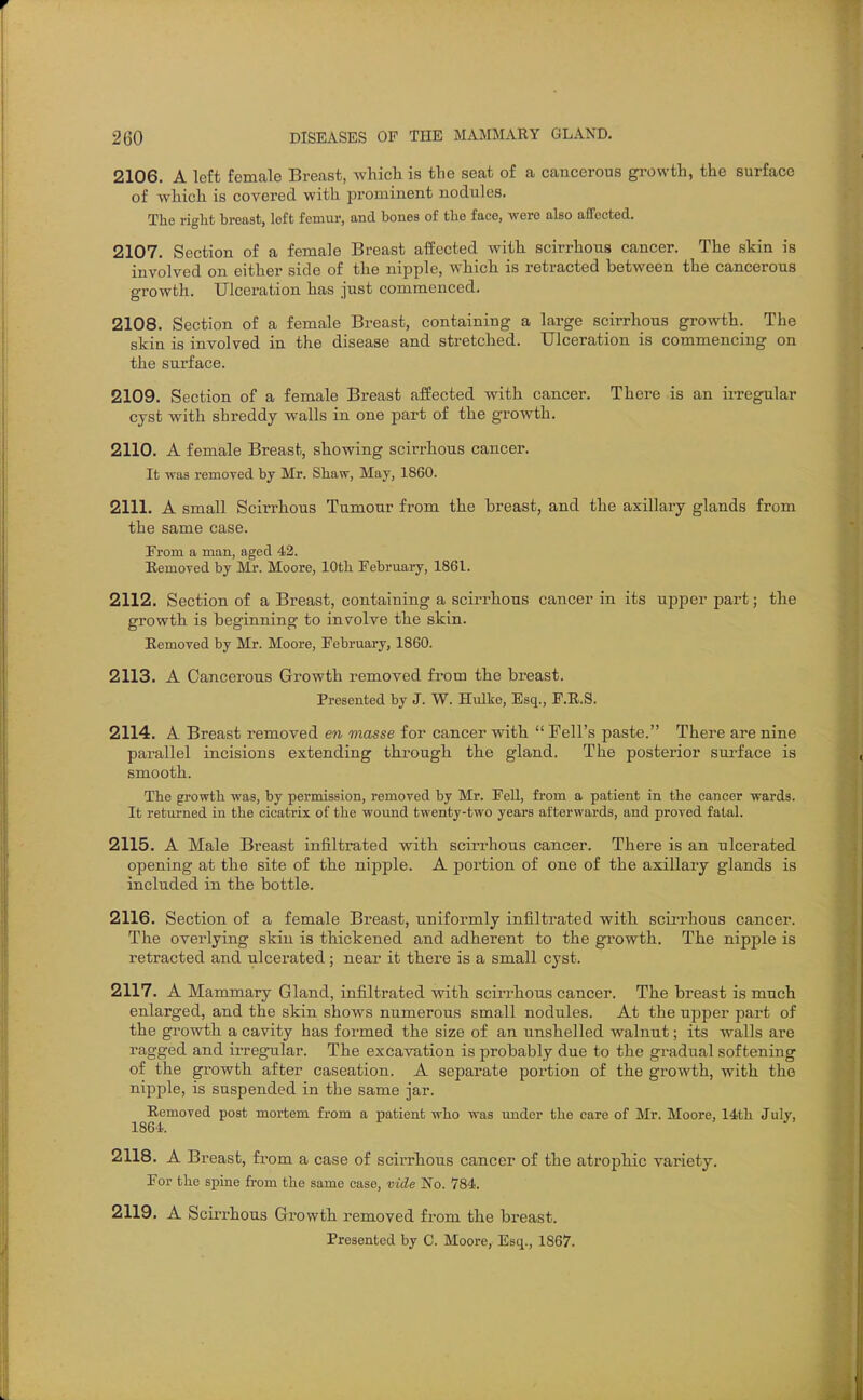 2106. A left female Breast, whicli is tbe seat of a cancerous growth, the surface of which is covered with prominent nodules. The right breast, left femur, and bones of the face, were also affected. 2107. Section of a female Breast affected with scirrhous cancer. The skin is involved on either side of the nipple, which is retracted between the cancerous growth. Ulceration has just commenced. 2108. Section of a female Breast, containing a large scirrhous growth. The skin is involved in the disease and stretched. Ulceration is commencing on the surface. 2109. Section of a female Breast affected with cancer. There is an irregular cyst with shreddy walls in one part of the growth. 2110. A female Breast, showing scirrhous cancer. It was remoTod by Mr. Shaw, May, 1860. 2111. A small Scirrhous Tumour from the breast, and the axillary glands from the same case. From a man, aged 42. EemoTcd by Mr. Moore, lOtli February, 1861. 2112. Section of a Breast, containing a scirrhous cancer in its upper part; the growth is beginning to involve the skin. Eemoved by Mr. Moore, February, 1860. 2113. A Cancerous Growth removed from the breast. Presented by J. W. Hulke, Esq., P.E.S. 2114. A Breast removed en masse for cancer with  Fell's paste. There are nine parallel incisions extending through the gland. The posterior sui'face is smooth. The growth was, by permission, removed by Mr. Fell, from a patient in the cancer wards. It returned in the cicatrix of the wound twenty-two years afterwards, and proved fatal. 2115. A Male Breast infiltrated with scirrhous cancer. There is an ulcerated opening at the site of the nipple. A portion of one of the axillary glands is included in the bottle. 2116. Section of a female Breast, uniformly infiltrated with scirrhous cancer. The overlying skin is thickened and adherent to the growth. The nipple is retracted and ulcerated; near it there is a small cyst. 2117. A Mammary Gland, infiltrated with scirrhous cancer. The breast is much enlarged, and the skin shows numerous small nodules. At the upper part of the growth a cavity has formed the size of an nnshelled walnut; its walls are ragged and irregular. The excavation is probably due to the gradual softening of the growth after caseation. A separate portion of the growth, with the nipple, is suspended in the same jar. Removed post mortem from a patient who was under the care of Mr. Moore, 14th July, 1864. 2118. A Breast, from a case of scirrlious cancer of the atrophic variety. For the spine from the same case, vide No. 784. 2119. A Scirrhous Growth removed from the bi-east.