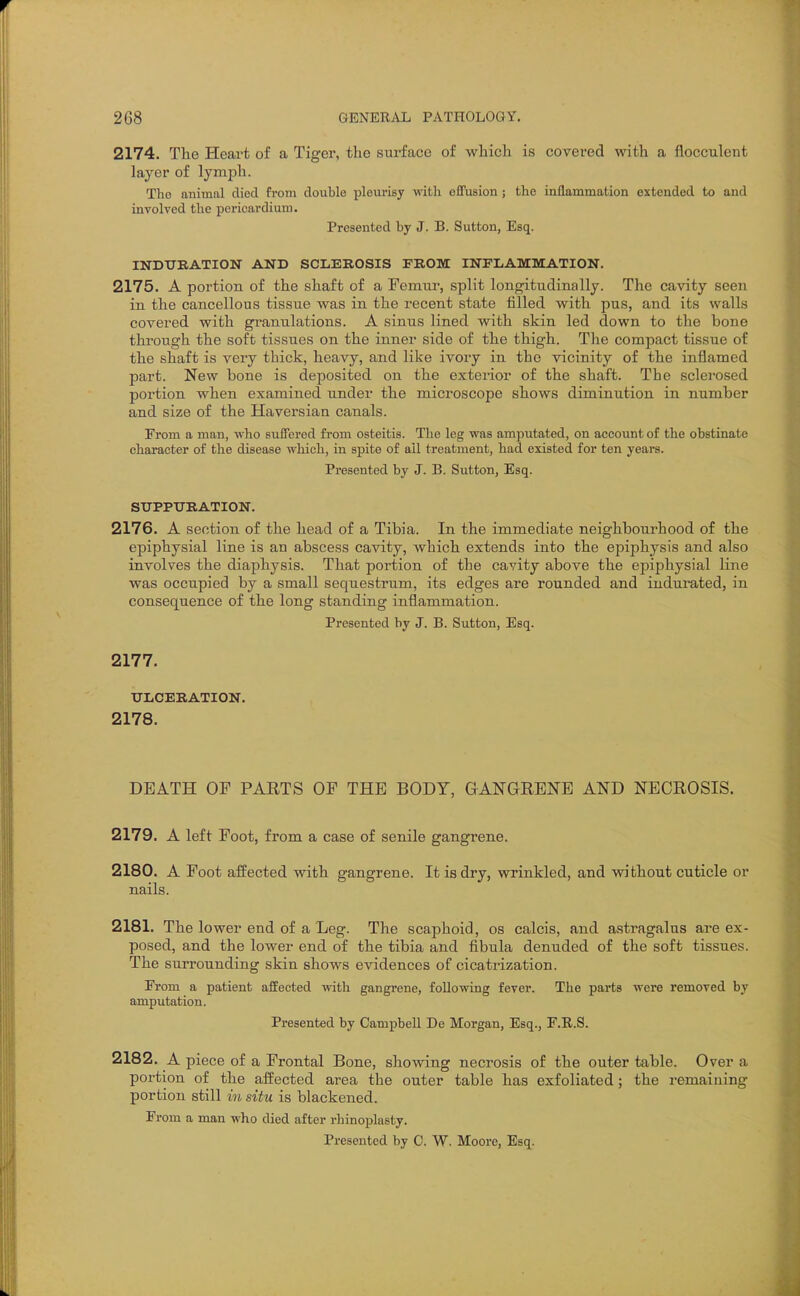2174. The Heart of a Tiger, the surface of which is covered with a flocculent layer of lymph. The animal died from double pleurisy with effusion ; the inflammation extended to and involved the pericardium. Presented by J. B. Sutton, Esq. INDTTRATION AND SCIiEROSIS FROM INFLAMMATION. 2175. A portion of the shaft of a Femui-, split longitudinally. The cavity seen in the cancellous tissue was in the recent state tilled with pus, and its walls covered with granulations. A sinus lined with skin led down to the bone tkrough the soft tissues on the inner side of the thigh. The compact tissue of the shaft is very thick, heavy, and like ivory in the vicinity of the inflamed part. New bone is deposited on the exterior of the shaft. The sclerosed portion when examined under the microscope shows diminution in number and size of the Haversian canals. From a man, vrho suffered from osteitis. The leg was amputated, on account of the obstinate character of the disease which, in spite of ail treatment, had existed for ten years. Presented by J. B. Sutton, Esq. STTPPTTRATION. 2176. A section of the head of a Tibia. In the immediate neighbourhood of the epiphysial line is an abscess cavity, which extends into the epiphysis and also involves the diaphysis. That portion of the cavity above the epiphysial line was occupied by a small sequestrum, its edges are rounded and indurated, in consequence of the long standing inflammation. Presented by J. B. Sutton, Esq. 2177. XTLCERATION. 2178. DEATH OF PARTS OF THE BODY, GANGRENE AND NECROSIS. 2179. A left Foot, from a case of senile gangrene. 2180. A Foot affected with gangrene. It is dry, wrinkled, and without cuticle or nails. 2181. The lower end of a Leg. The scaphoid, os calcis, and astragalus are ex- posed, and the lower end of the tibia and fibula denuded of the soft tissues. The surrounding skin shows evidences of cicatrization. From a patient affected with gangrene, following fever. The parts were removed by amputation. Presented by Campbell De Morgan, Esq., F.R.S. 2182. A piece of a Frontal Bone, showing necrosis of the outer table. Over a portion of the affected area the outer table has exfoliated; the remaining portion still iv, situ is blackened. From a man who died after rhinoplasty.