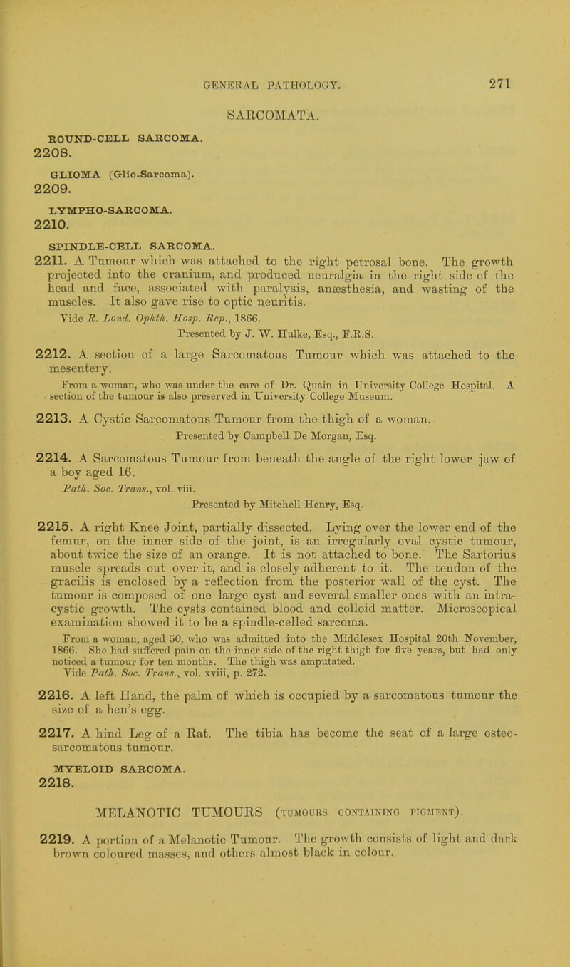 SARCOMATA. ROUND-CELL SARCOMA. 2208. GLIOMA (Glio-Sarcoma). 2209. LYMPHO-SARCOMA. 2210. SPINDLE-CELL SARCOMA. 2211. A Tumom* which was attached to the right petrosal bone. The growth projected into the cranium, and produced neuralgia in the right side of the head and face, associated with paralysis, anaesthesia, and wasting of the muscles. It also gave rise to optic neuritis. Vide R. Lond. Ophth. Hosp. Rep., 18G6. Presented by J. W. Hulke, Esq., T.E.S. 2212. A section of a large Sarcomatous Tumour which was attached to the mesentery. From a woman, who was tinder the care of Dr. Quain in University College Hospital. A section of the tumour is also preserved in University College Museum. 2213. A Cystic Sarcomatous Tumour from the thigh of a woman. Presented by Campbell De Morgan, Esq. 2214. A Sarcomatous Tumour from beneath the angle of the right lower jaw of a boy aged 16. Path. Soe. Trans., vol. viii. Presented by Mitchell Henry, Esq. 2215. A right Knee Joint, partially dissected. Lying over the lower end of the femur, on the inner side of the joint, is an irregularly oval cystic tumour, about twice the size of an orange. It is not attached to bone. The Sartorius muscle spreads out over it, and is closely adherent to it. The tendon of the gracilis is enclosed by a reflection fi'om the posterior wall of the cyst. The tumour is composed of one large cyst and several smaller ones with an intra- cystic growth. The cysts contained blood and colloid matter. Mici'oscopical examination showed it to be a spindle-celled sarcoma. From a woman, aged 50, who was admitted into the Middlesex Hospital 20th November, 1866. She had suffered pain on the inner side of the right thigh for five years, but had only noticed a tumour for ten months. The thigh was amputated. Vide Path. Soc. Trans., vol. xviii, p. 272. 2216. A left Hand, the palm of which is occupied by a sarcomatous tumour the size of a hen's egg. 2217. A hind Leg of a Rat. The tibia has become the seat of a large osteo- sarcomatous tumour. MYELOID SARCOMA. 2218. MELANOTIC TUMOURS (tumours coNTAmrNQ pigment). 2219. A portion of a Melanotic Tumour. The growth consists of light and dark brown coloured masses, and others almost black in colour.