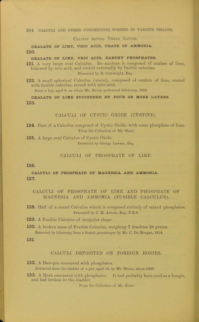 Calculi having Thrke Laykes. oxalate of lime, uric acid, urate oe ammonia. 120. OXALATE OF LIME, URIC ACID, EARTHY PHOSPHATES. 121. A veiy large oval Calculus. Its nucleus is composed of oxalate of lime, followed by uric acid, and coated externally by fusible calculus. Presented by R. Cartwriglit, Esq. 122. A small spberical Calculus (uncut), composed of oxalate of lime, coated with, fusible calculus, mixed with uric acid. From a boy, aged 8, on wliom Mr. Henry jDerformed lithotomy, 1859. OXALATE OF LIME SUCCEEDED BY FOUR OR MORE LAYERS. 123. CALCULI OP CYSTIC OXIDE (CYSTINE). 124. Part of a Calculus composed of Cystic Oxide, with some phosphate of lime. From tlie Collection of Mr. Shaw. 125. A large oval Calculus of Cystic Oxide. Presented bj Greorge Lawson, Esq. CALCULI OP PHOSPHATE OP LIME. 126. CALCULI OF PHOSPHATE OF MAGNESIA AND AMMONIA. 127. CALCULI OF PHOSPHATE OF LIME AND PHOSPHATE OF MAGNESIA AND AMMONIA (FUSIBLE CALCULUS). 128. Half of a round Calculus which is composed entirely of mixed ptospbates. Presented by J. M. Arnott, Esq., F.R.S. 129. A Fusible Calculus of irregular shape. 130. A broken mass of Fusible Calculus, weigiiing 7 drachms 24 grains. RemoTed by lithotomy from a Scotch gamekeeper bj Mr. C. De Morgan, 1854. 131. CALCULI DEPOSITED ON FOEEIGN BODIES. 132. A Hair-pin encrusted with phosphates. Extracted from the bladder of a gii-1, aged 15, by Mr. Moore, about 1850. 133. A Rush encrusted with pbosphates. It had probably been used as a bougie, and had broken in the bladder. From the Collection of Mr. Shaw.