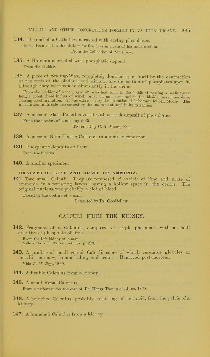 134. The end of a Catheter encrusted witli eartliy phosjiliates. It had been kept in the blaildor for five days in a case of lacerated iirctliva. From the Collection of Mr. Shaw. 135. A Hair-pin encrusted with phosphatic deposit. From the bladder. 136. A piece of Sealing-Wax, completely doubled upon itself by the contraction of the coats of the bladder, and without any deposition of phosphates upon it, although they were voided abundantly in the urine. From the bladder of a man, aged 42, who had been in the habit of passing a sealing-wax bougie, about three inches of whiuli broke olf and remained in the bladder seventeen days, causing much irritation. It was extracted by the operation of lithotomy by Mr. Moore. I'he indentation in its side was caused by the instrument used in its extraction. 137. A piece of Slate Pencil covered with a thick deposit of phosphates. From the urethra of a man, aged 45. Presented by C. A. Moore, Esq. 138. A piece of Gum Elastic Catheter in a similar condition. 139. Phosphatic deposits on hairs. From the bladder. 140. A similar specimen. ■ OXALATE OF LIME AND TTBATE OF AMMONIA. 141. Tavo small Calculi. They are composed of oxalate of lime and urate of ammonia in alternating layers, having a hollow space in the centre. The original nucleus was probably a clot of blood. Passed by the urethra of a man. Presented by Dr. Goodfellow. CALCULI FEOM THE KIDNEY. 142. Fragment of a Calculus, composed of triple phosphate with a small quantity of phosphate of lime. From the left kidney of a man. Vide Path. Soc. Trans., vol. xix, p. 278. 143. A number of small round Calculi, some of which resemble globules of metallic mercury, from a kidney and ureter. Removed post-mortem. Vide P. M. Heff., 1860. 144. A fusible Calculus from a kidney. 145. A small Renal Calculus. From a patient under the care of Dr. Henry Thompson, Junc, 1860. 146. A branched Calculus, probably consisting of uric acid, from the pelvis of a kidney. 147. A branched Calculus From a kidney.