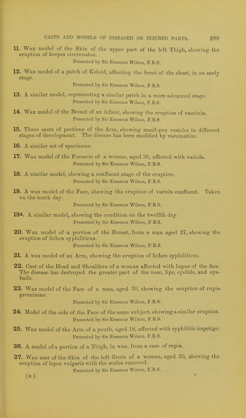 11. Wax model of tlio Skin of the upper part of tlie left Thigh, showing the eruption of herpes circinnatus. Presented by Su- ErnBmus Wilson, P.R.S. 12. Wax model of a patch of Keloid, affecting the front oE the chest, in an early stage. Presented by Sh- Erasmus Wilson, F.R.S. 13. A similar model, representing a similar patch in a more advanced stage. Presented by Sir Ersismus Wilson, F.R.S. 14. Wax model of the Breast of an infant, showing the eruption of vaccinia. Presented by Sir Erasmus Wilson, P.E.S. 15. Three casts of portions of the Arm, showing small-pox vesicles in different stages of development. The disease has been modified by vaccination. 16. A similar set of specimens. 17. Wax model of the Forearm of a woman, aged 36, affected with variola. Presented by Sir Erasmus Wilson, F.K.S. 18. A similar model, showing a confluent stage of the eruption. Presented by Sii* Erasmus Wilson, E.R.S. 19. A wax model of the Face, showing the eruption of variola confluent. Taken on the tenth day. Presented by Sir Erasmus Wilson, E.B/.S. 19^. A similar model, showing the condition on the twelfth day. Presented by Sir Erasmus Wilson, E.E..S. 20. Wax model of a portion of the Breast, from a man aged 27, showing the eruption of lichen syphiliticus. Presented by Sir Erasmus Wilson, E.R.S. 21. A wax model of an Arm, showing the eruption of lichen syphiliticus. 22. Cast of the Head and Shoulders of a woman affected with lupus of the face. The disease has destroyed the greater part of the nose, lips, eyelids, and eye- balls. 23. Wax model of the Face of a man, aged 30, showing the eruption of rupia prominens. Presented by Sii* Erasmus Wilson, F.R.S. 24. Model of the side of the Face of the same subject, showing a similar eruption. Presented by Sir Erasmus Wilson, F.R.S. 25. Wax model of the Arm of a youth, aged 18, affected with syphilitic impetigo. Presented by Sir Erasmus Wilson, F.R.S. 26. A model of a portion of a Thigh, in wax, from a case of rupia. 27. Wax cast of the Skin of the left Groin of a woman, aged 20, showing the eruption of lepra vulgaris with the scales removed. Presented by Sir Erasmus Wilson, F.R.S. (M.) U